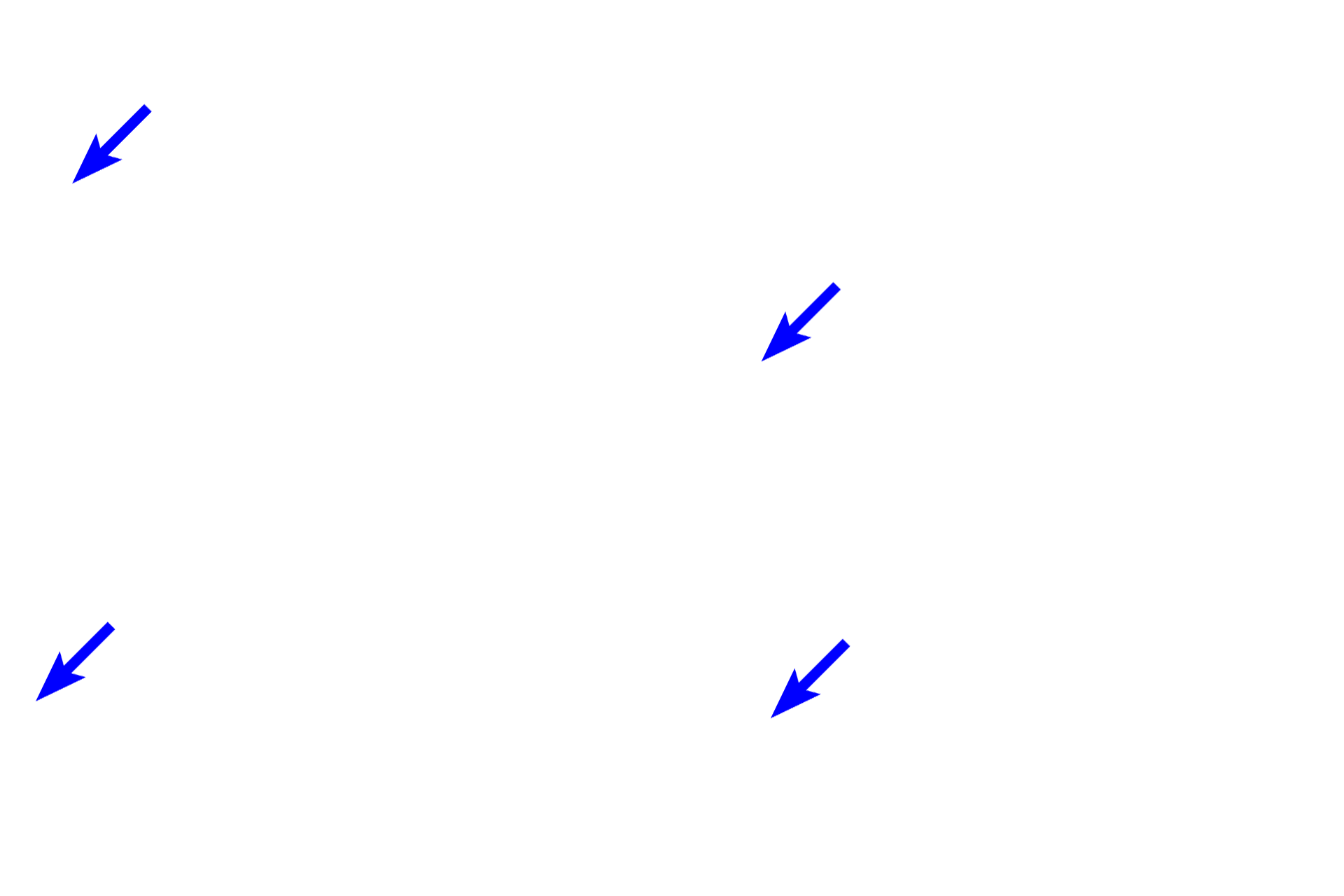 Ostocytes >  <p>When osteoblasts become surrounded by bone matrix, they become osteocytes. </p>
