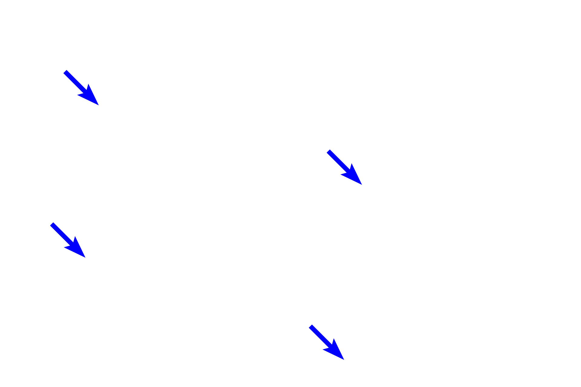 Cementum <p>The principal fibers of the periodontal ligament secure the tooth in the socket and consist of five major subgroups:  alveolar crest, horizontal, oblique, apical, and interradicular fibers, on multi-root teeth.  These collagen fibers connect the cementum to the alveolar bone and grouped according to the regions they connect.  Three of the five groups are visible in these images.  100x</p>
