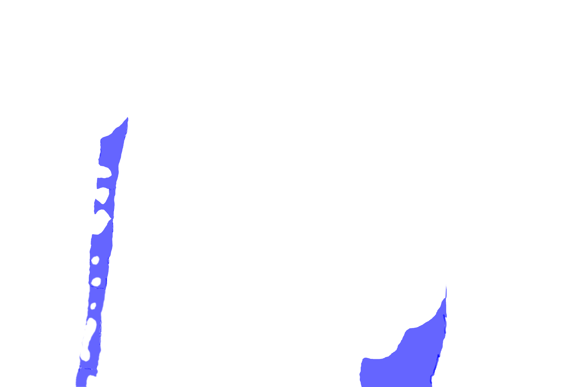 Oblique principal fibers >  <p>The oblique principal fibers are the most numerous fibers in the periodontal ligament.  They connect the cementum along the remaining length of the root to the alveolar bone proper. These fibers provide the majority of support against the forces of mastication. </p>
