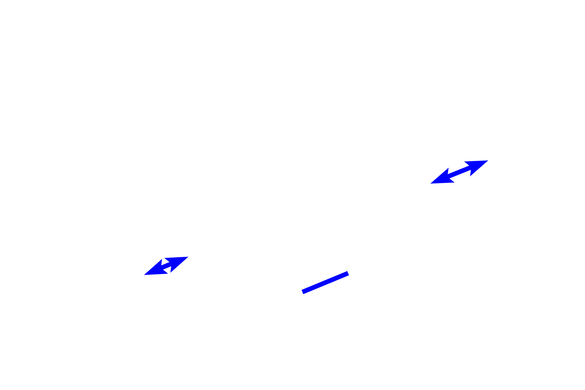 Alveolar bone <p>The dental alveolus is the bony socket that surrounds the root of the tooth.  The socket is form by alveolar bone which differentiates from ectomesenchymal stem cells of the dental follicle.</p>
