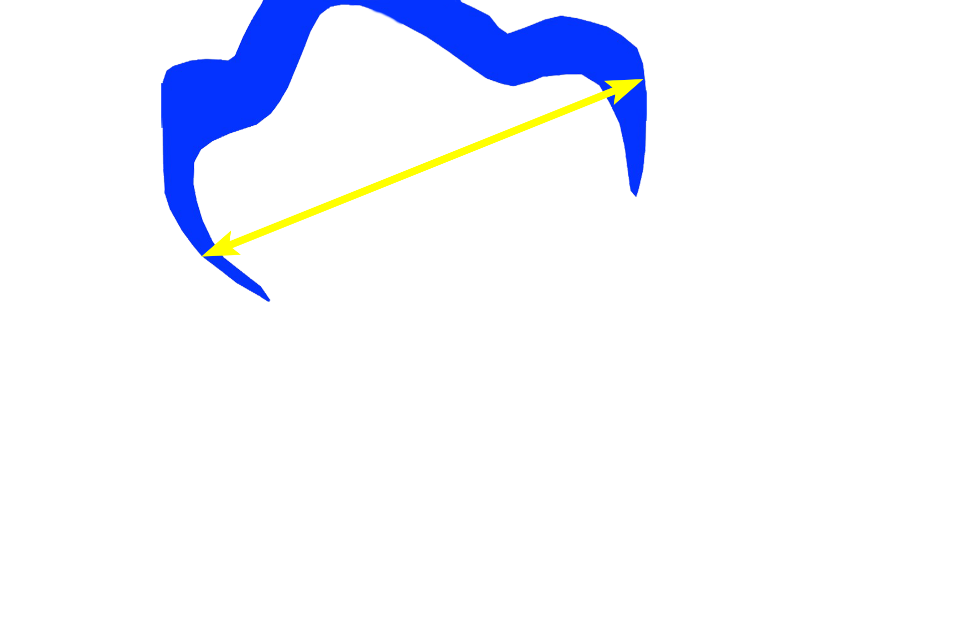 Crown >  <p>The crown of the tooth extends above the gum line and is covered by enamel.  Enamel, which is digitally added this image, is not retained in this section as a result of the decalcification process used during tissue preparation.</p>
