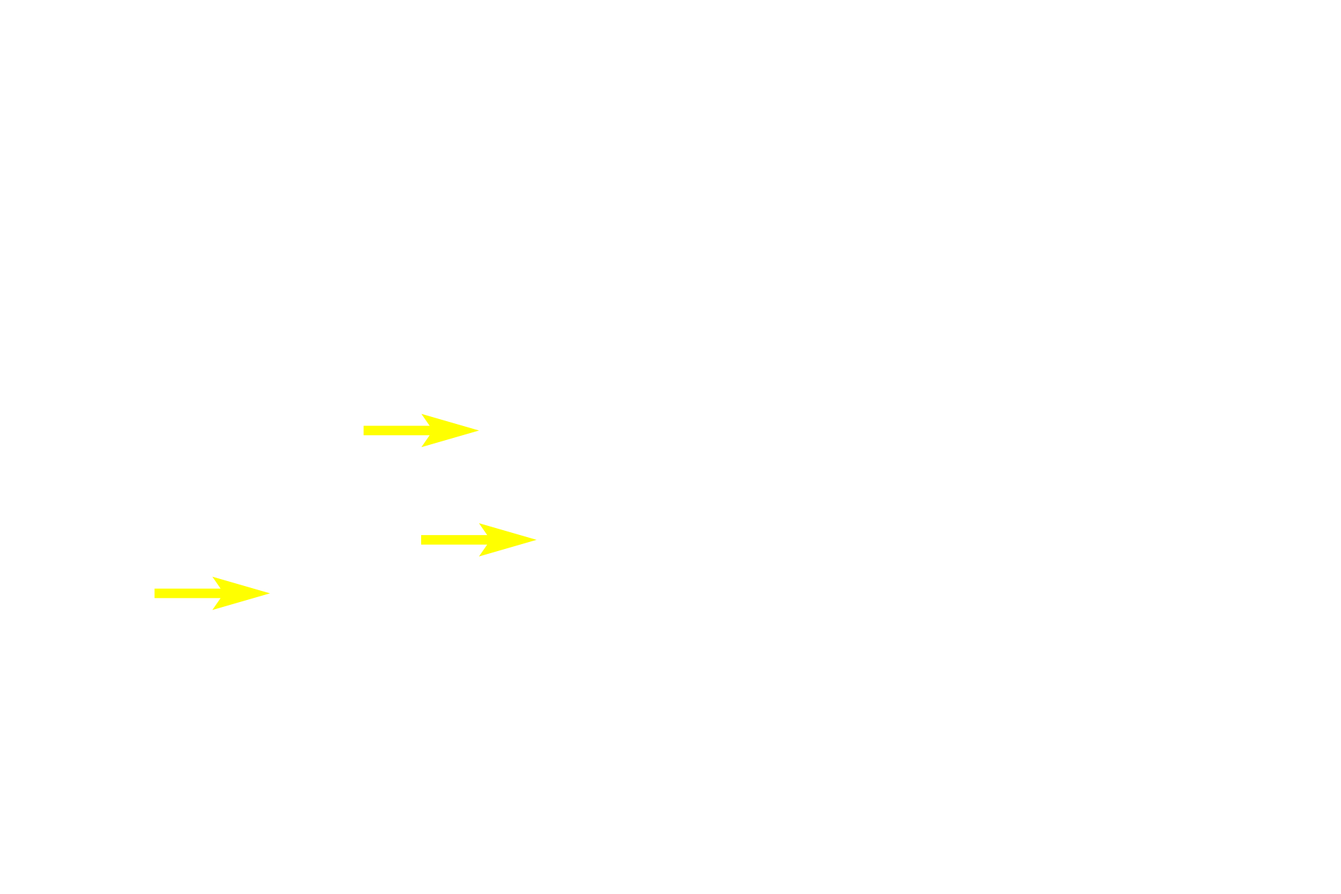 Radicular pulp >  <p>Radicular pulp is contained within the pulp cavity in the root of the tooth and is continuous with the connective tissue of the periodontal ligament at the apical foramen.  An odontoblastic layer, as well as cell free and cell rich zones are also present in the radicular pulp.  </p>
