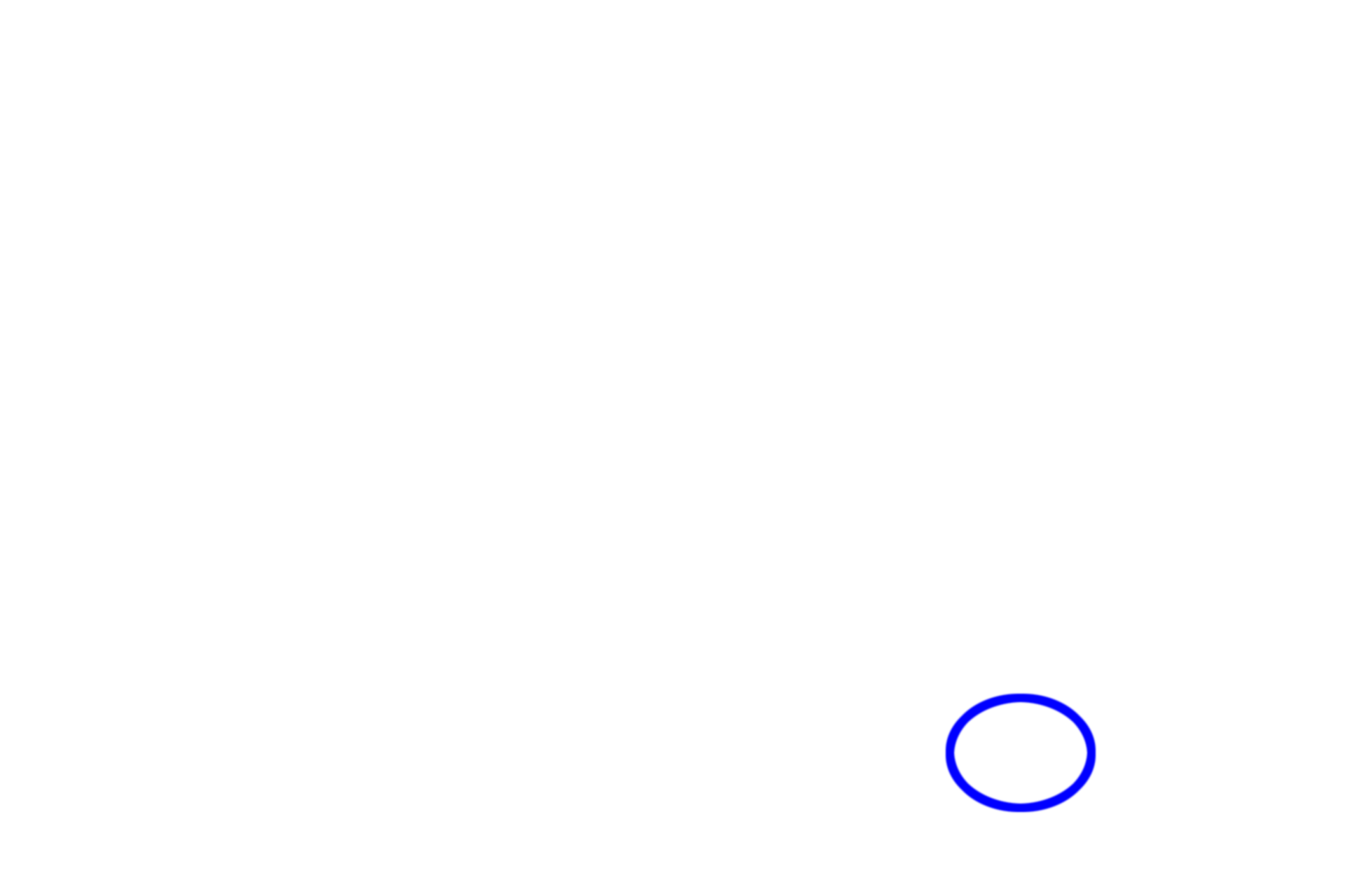  - Dental papilla > <p>The bulk of the ectomesenchymal cells that differentiate into the dental papilla will form the dental pulp.</p>
