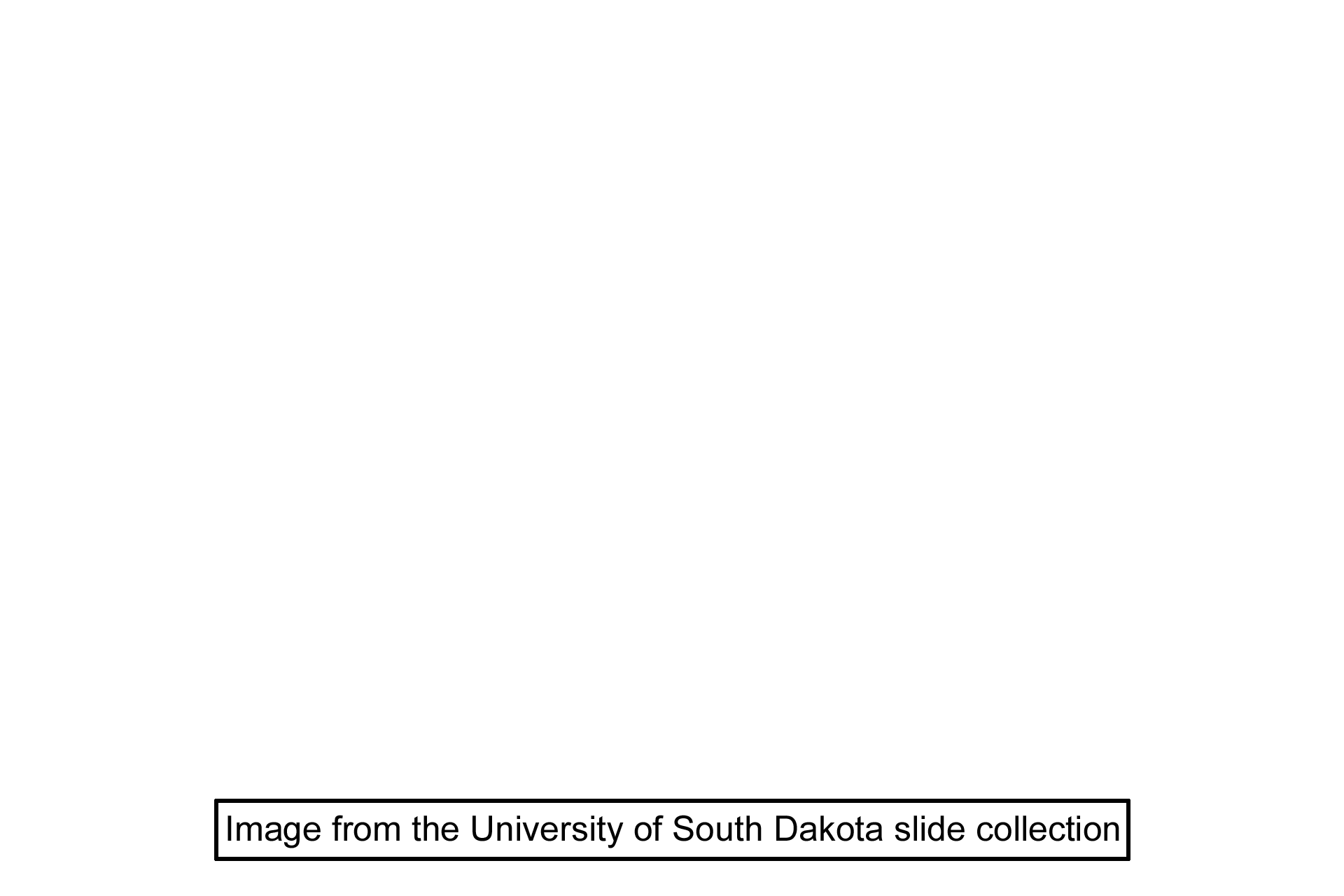 Image source >  <p>This image is taken of slide in the University of South Dakota collection.</p>
