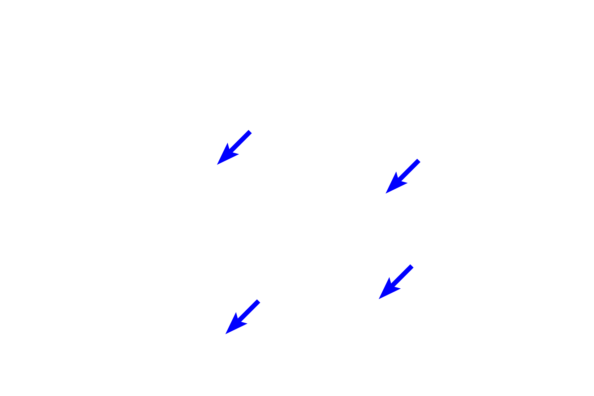 Dental follicle <p>During the bell stage of tooth development, the enamel organ grows into a bell shape.  Cytodifferentiation of the stem cells in the enamel organ and dental papilla is progressing and the dental lamina begins to degenerate.  This is also the stage when the morphology of the tooth is determined (morphodifferentiation).  The successional lamina is not visible in this section.</p>
