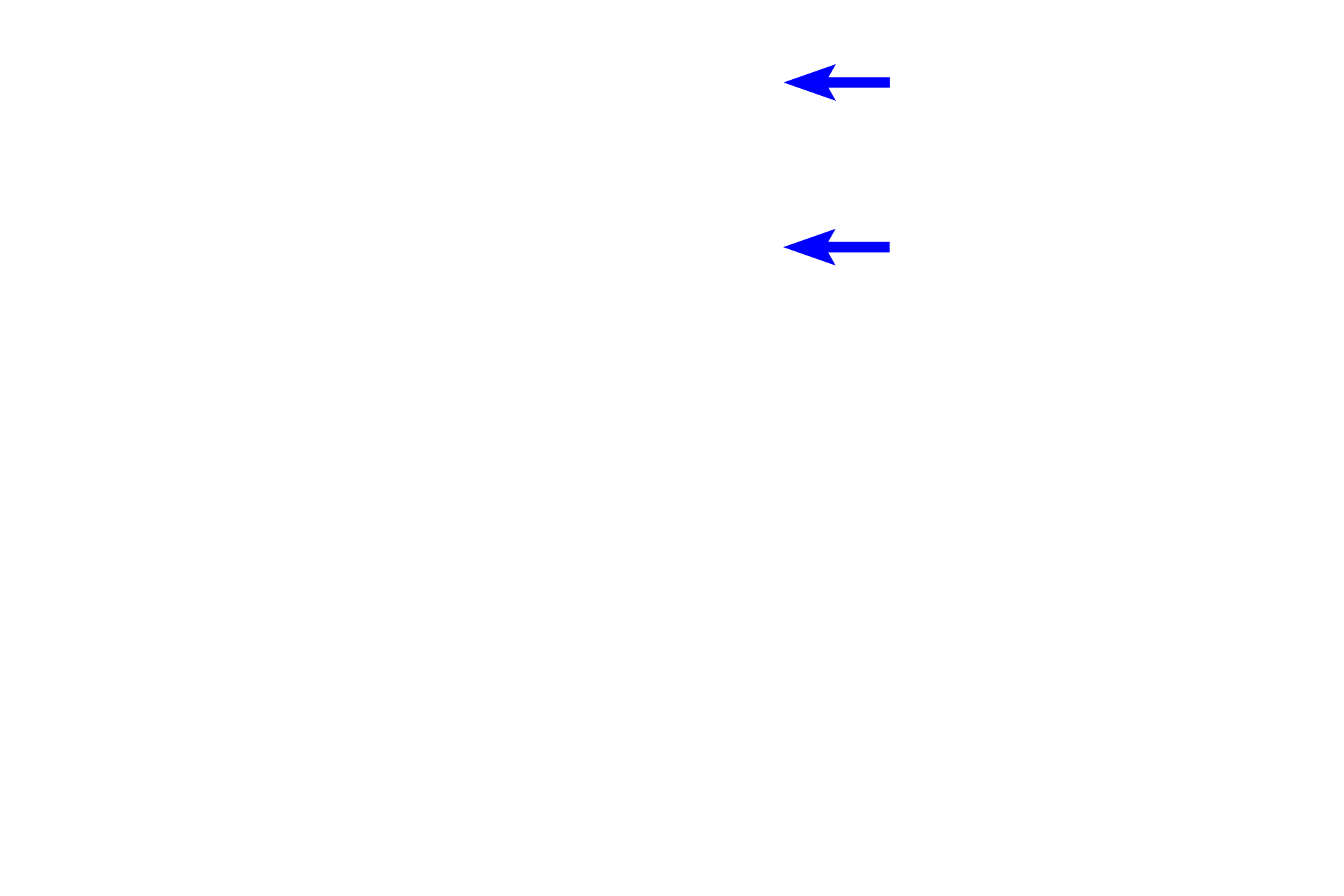 Dental lamina <p>During the bell stage of tooth development, the enamel organ grows into a bell shape.  Cytodifferentiation of the stem cells in the enamel organ and dental papilla is progressing and the dental lamina begins to degenerate.  This is also the stage when the morphology of the tooth is determined (morphodifferentiation).  The successional lamina is not visible in this section.</p>
