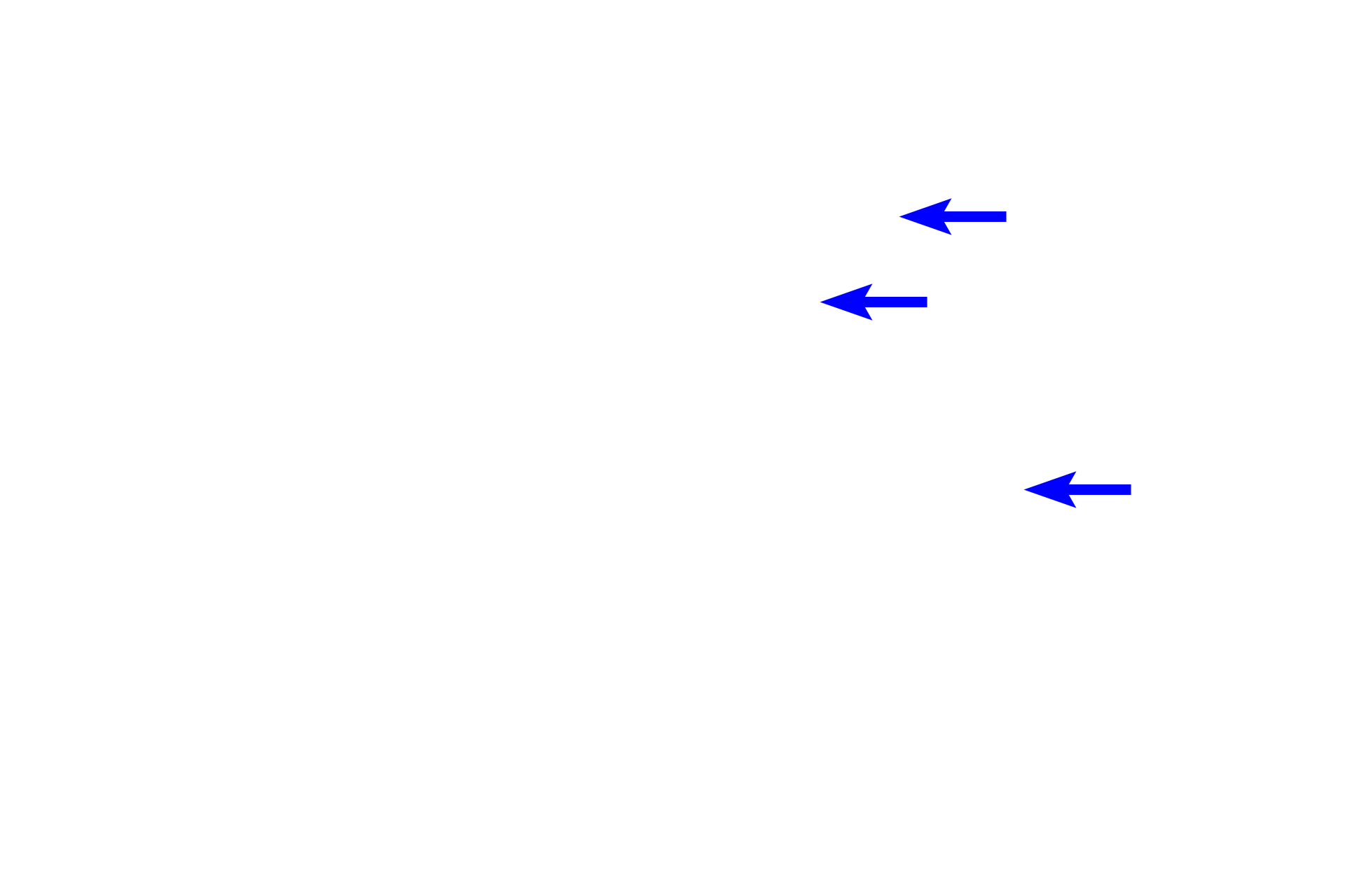 Dental lamina >  <p>The dental laminae above the developing mandible and maxilla invaginate at sites corresponding to the location of the deciduous teeth.  </p>
