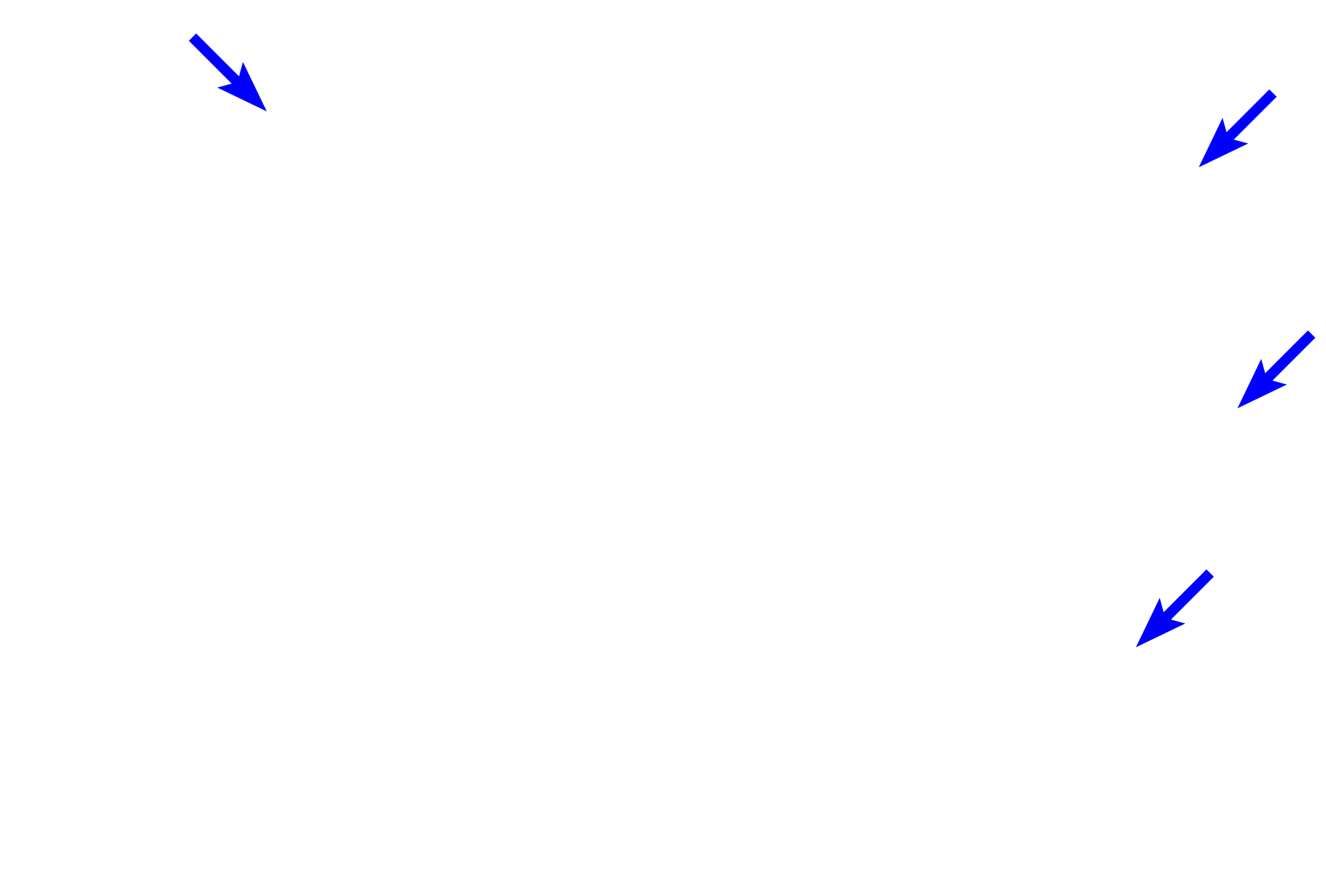 Developing alveolar bone > <p>Alveolar bone > Alveolar bone lines the tooth socket (alveolus) and anchors the tooth via the periodontal ligament. </p>
