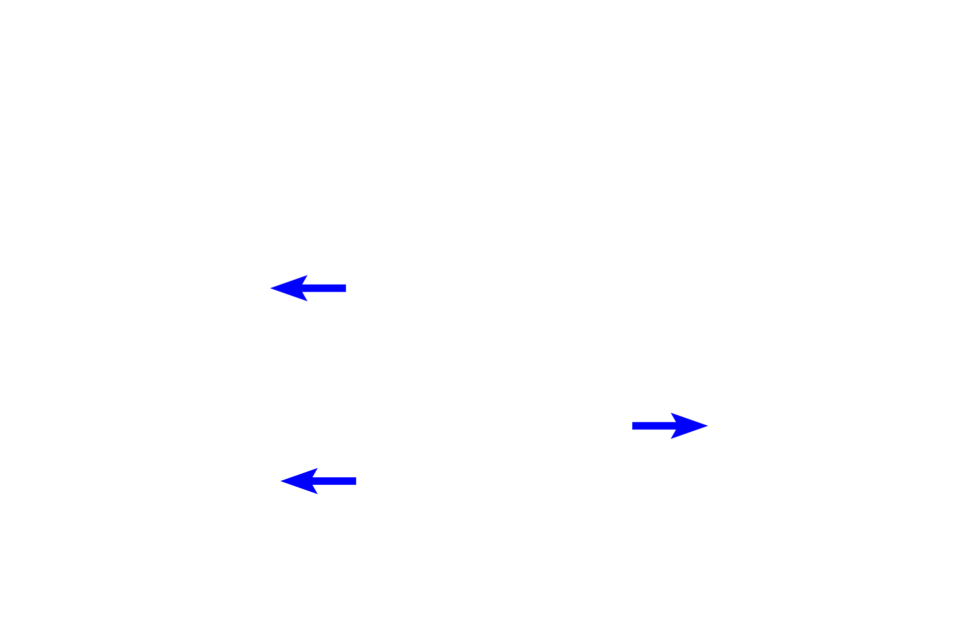 Developing alveolar bone <p>During the bell stage of tooth development, the enamel organ grows into a bell shape.  Cytodifferentiation of the stem cells in the enamel organ and dental papilla is progressing and the dental lamina begins to degenerate.  This is also the stage when the morphology of the tooth is determined (morphodifferentiation).  The successional lamina is not visible in this section.</p>
