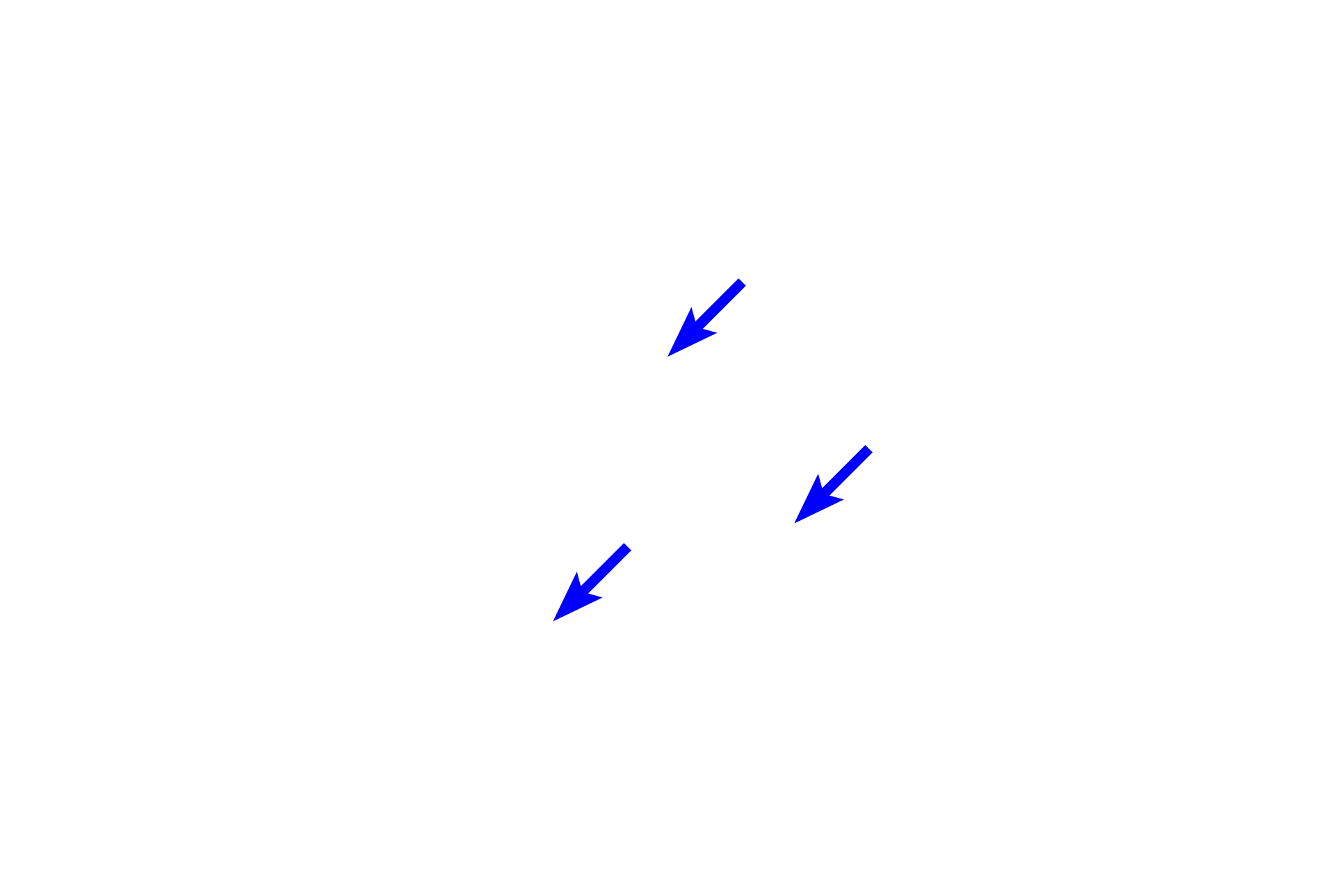  - Stellate reticulum <p>During the bell stage of tooth development, the enamel organ grows into a bell shape.  Cytodifferentiation of the stem cells in the enamel organ and dental papilla is progressing and the dental lamina begins to degenerate.  This is also the stage when the morphology of the tooth is determined (morphodifferentiation).  The successional lamina is not visible in this section.</p>
