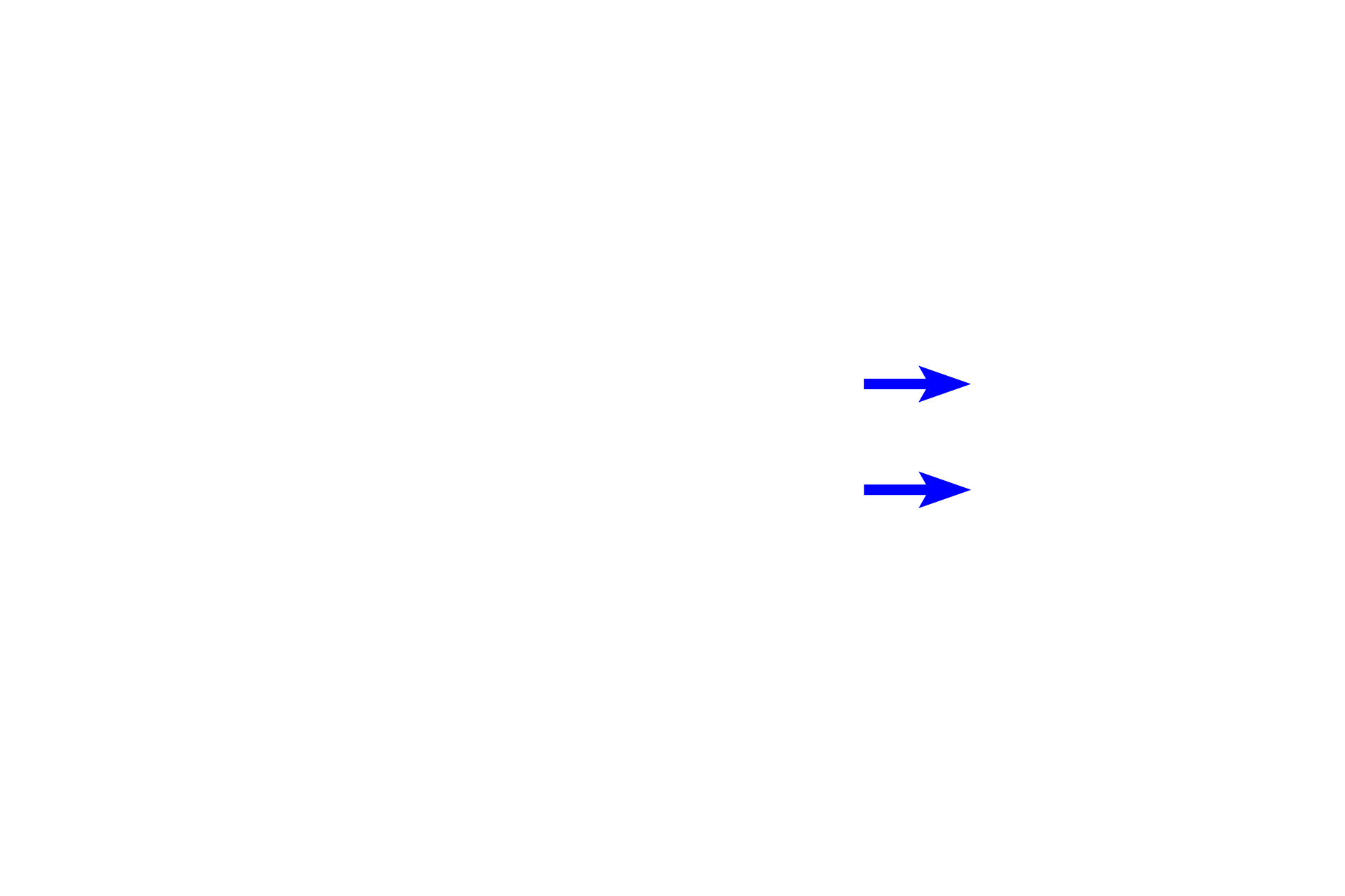 Successional lamina <p>During the bell stage, the dental lamina extends a successional lamina that forms the permanent (successional) teeth. </p>
