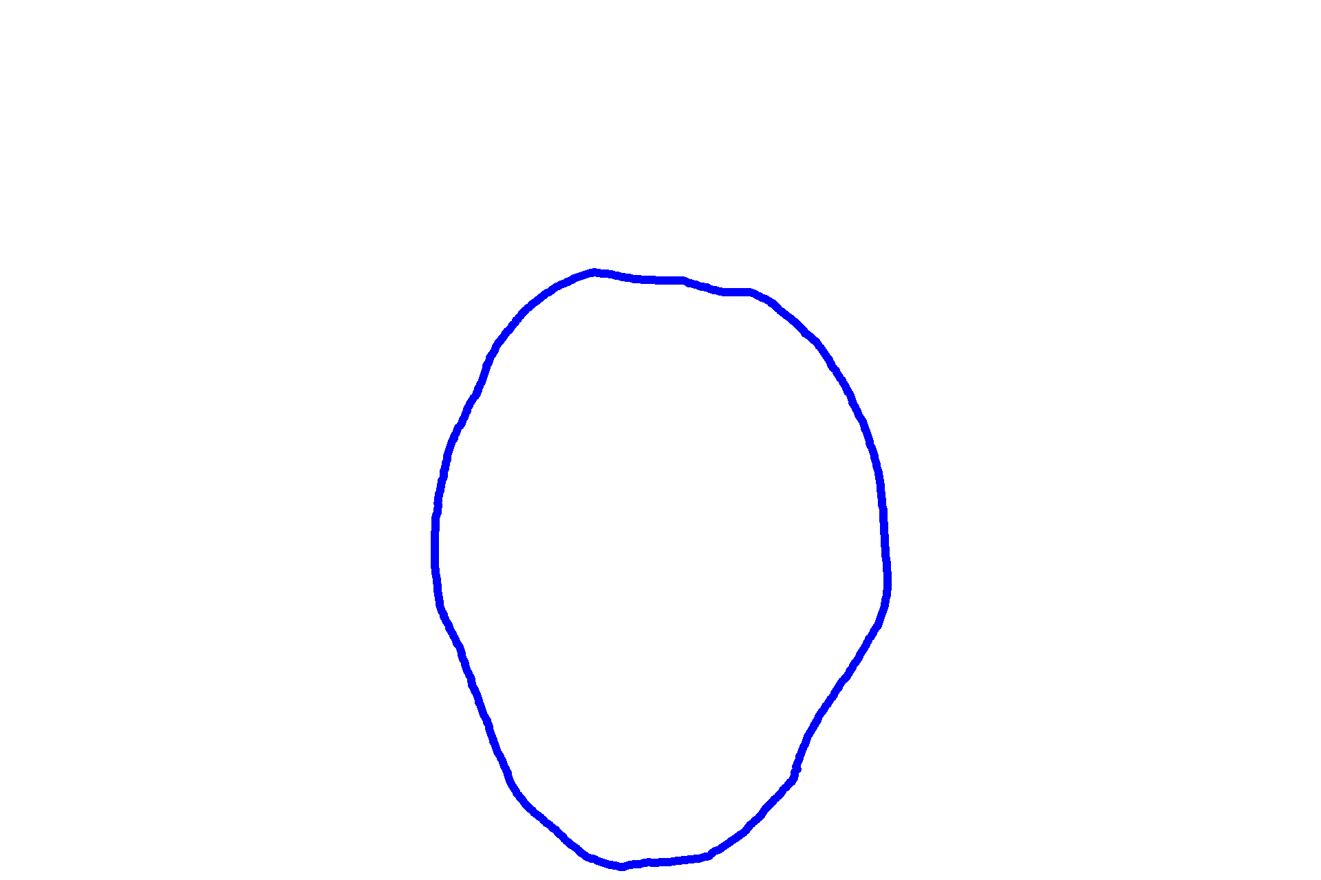 Tooth germ <p>During the bell stage of tooth development, the enamel organ grows into a bell shape.  Cytodifferentiation of the stem cells in the enamel organ and dental papilla is progressing and the dental lamina begins to degenerate.  This is also the stage when the morphology of the tooth is determined (morphodifferentiation).  The successional lamina is not visible in this section.</p>
