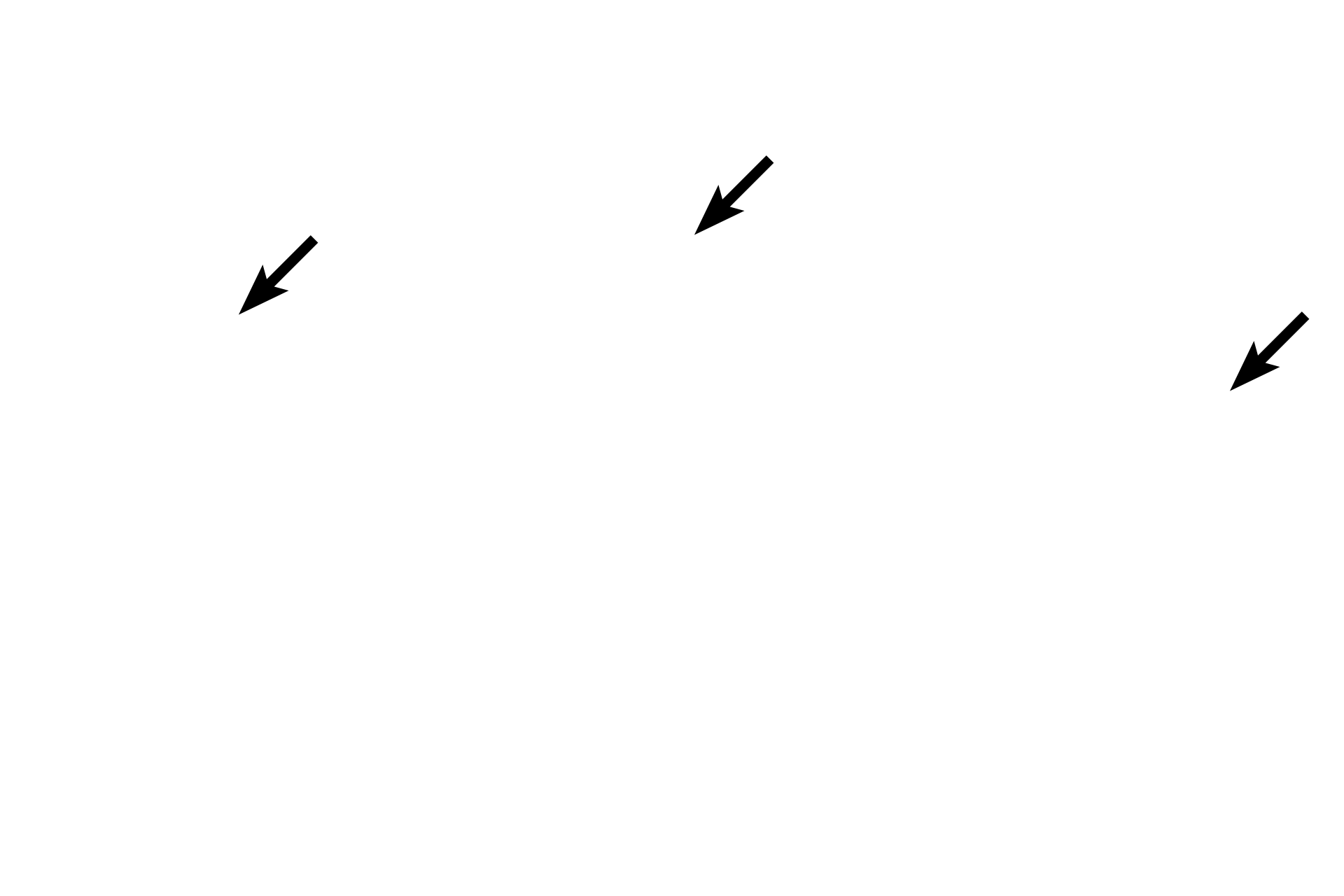  - Periosteal band <p>Three metacarpal bones of the fetal hand have been cut in cross section at different distances from the epiphyseal plate, showing the gradual resorption of bony spicules.  On the left, numerous spicules are present, indicating a region close to the epiphyseal plate.  On the right, few spicules remain, demonstrating an area closer to the mid-diaphysis. 10x</p>
