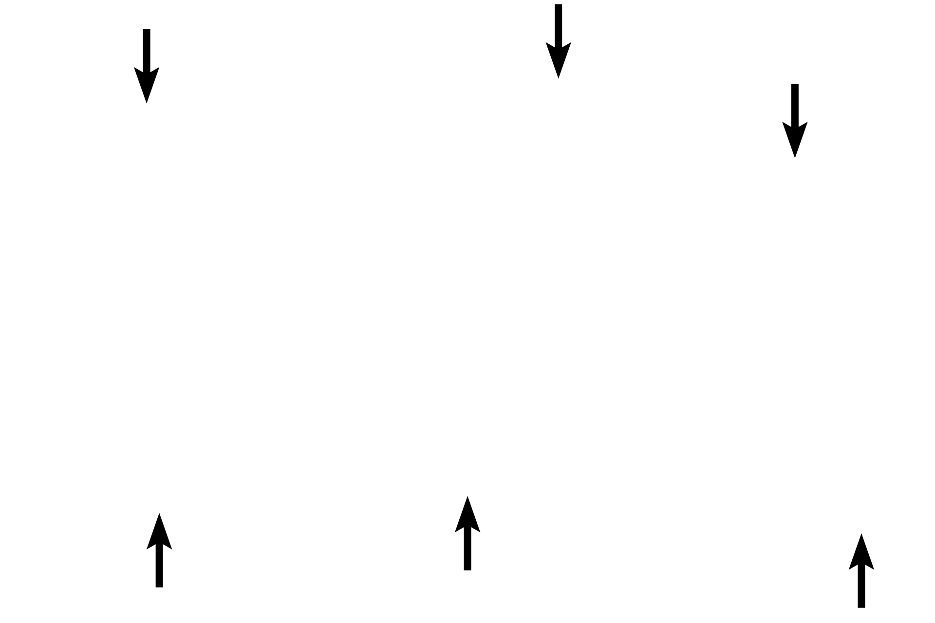 Skin <p>Three metacarpal bones of the fetal hand have been cut in cross section at different distances from the epiphyseal plate, showing the gradual resorption of bony spicules.  On the left, numerous spicules are present, indicating a region close to the epiphyseal plate.  On the right, few spicules remain, demonstrating an area closer to the mid-diaphysis. 10x</p>
