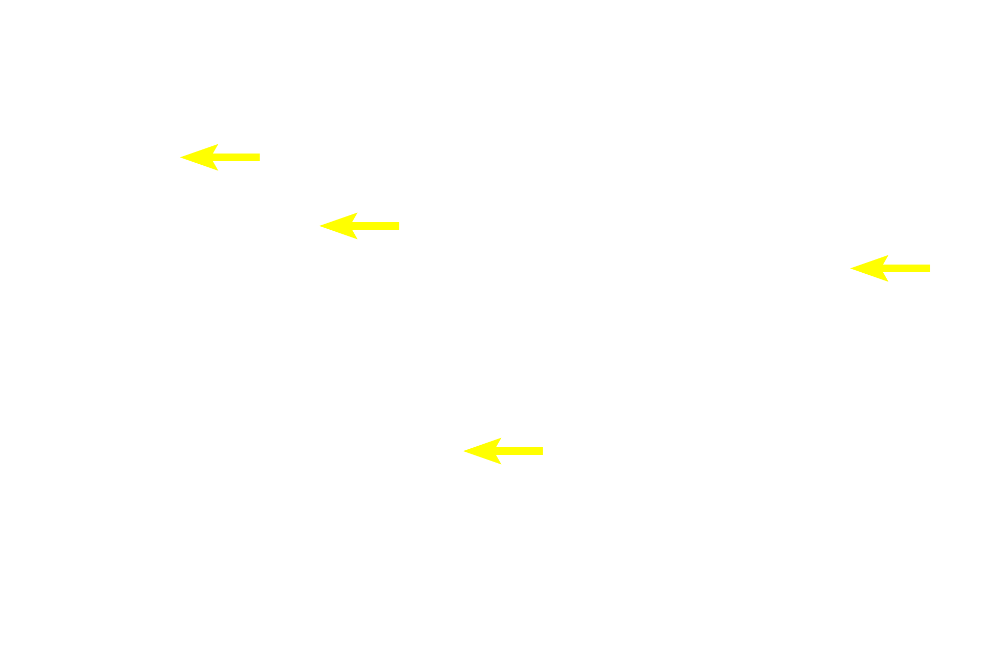 - Lamina propria <p>A trichrome stain of the mucosa and submucosa of the esophagus emphasizes the different tissues present. In this region the muscularis mucosae is incomplete, consisting of islands of smooth muscle, rather than a continuous layer. The longitudinal fold, with a core of submucosa, would flatten during expansion of the esophagus during food transport. 40x</p>