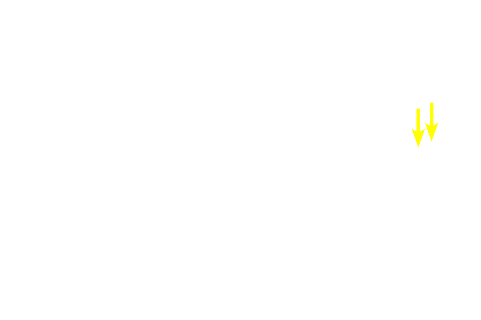 - Lymphoid nodule