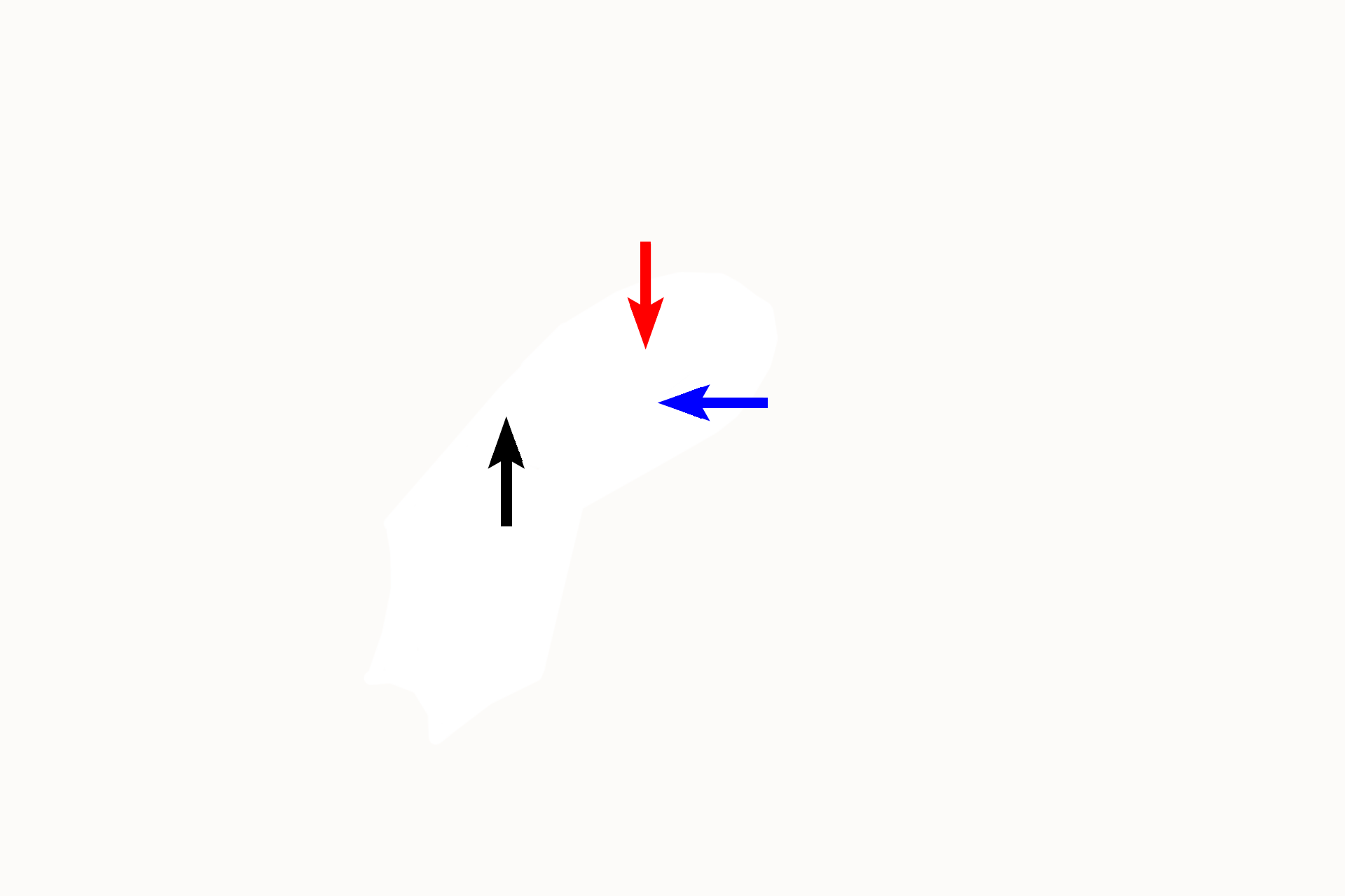 - Ossicles > <p>The auditory ossicles are three small bones spanning the tympanic cavity. The malleus (blue arrow) is attached to the tympanic membrane and articulates with the incus (red arrow). The incus is attached to the stapes (black arrow), whose foot plate fits into the oval window in the lateral wall of the inner ear. These ossicles transmit vibrations from the tympanic membrane to the inner ear.</p>