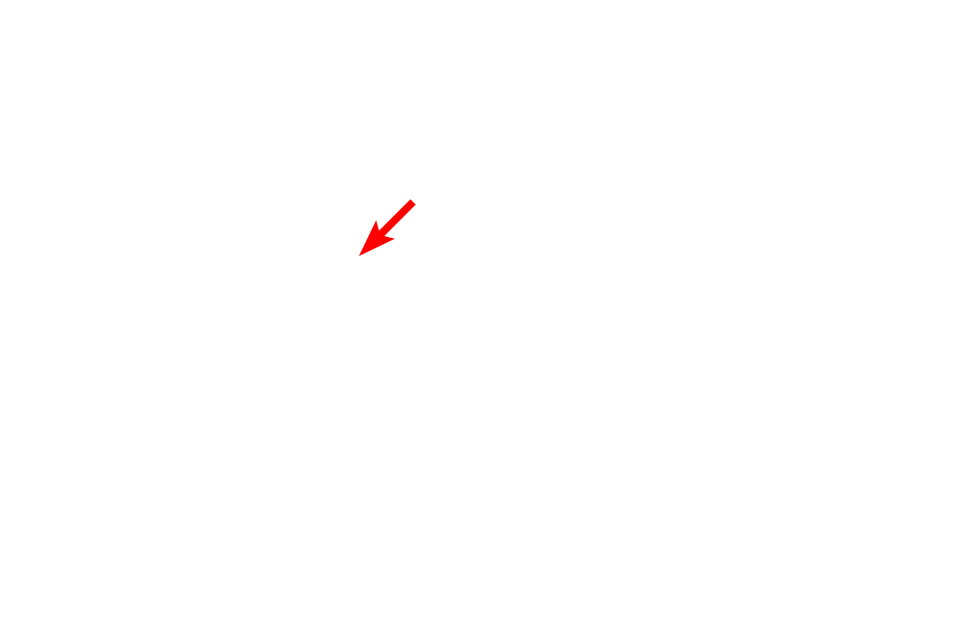 Stapes <p>The vestibule is the central space of the osseous labyrinth. Its lateral wall contains the oval window in which the foot plate of the stapes is located. The utricle and saccule, portions of the membranous labyrinth, are suspended in the vestibule but are not illustrated here.</p>