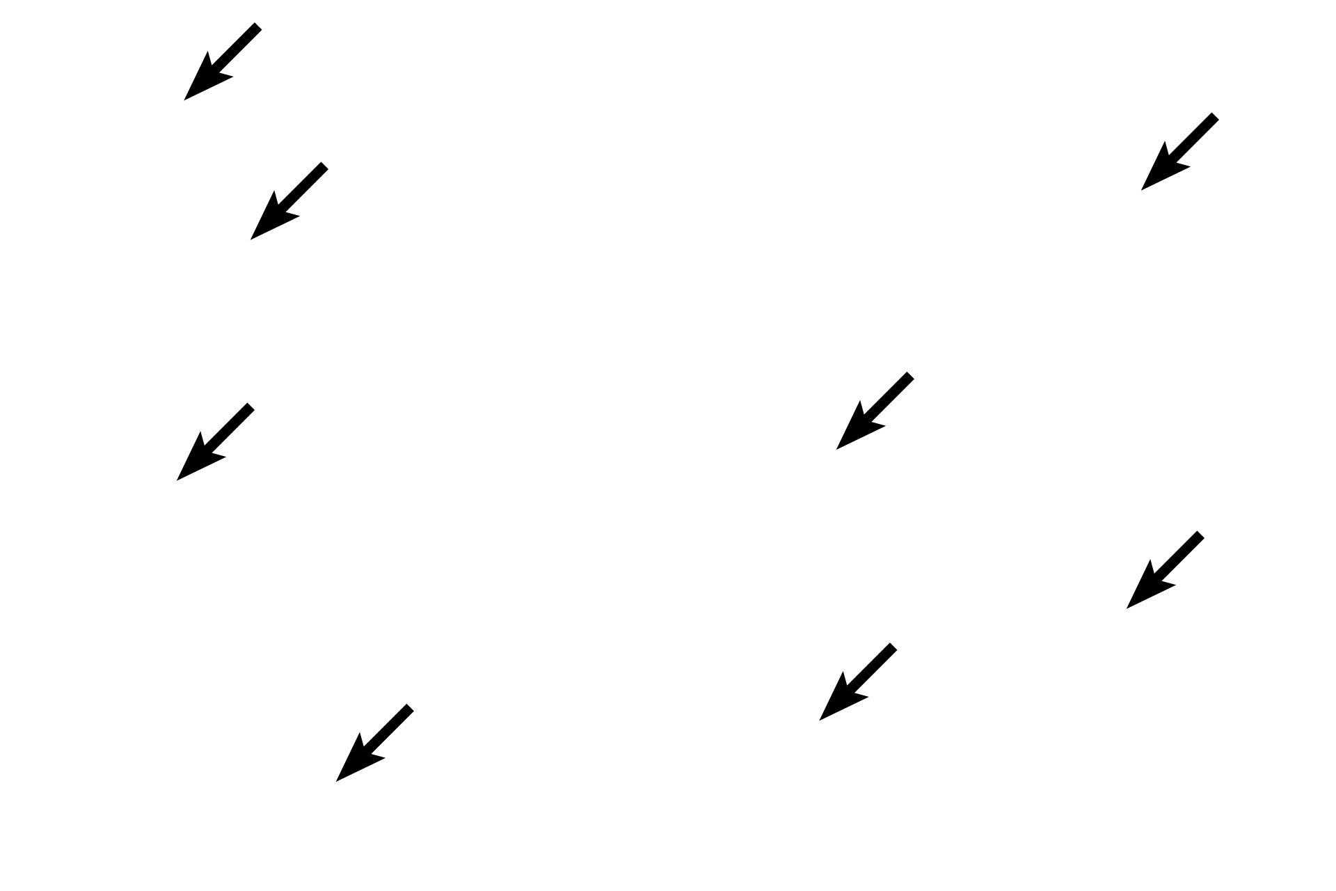 Osteocytes > <p>Woven (immature) bone contains a larger number of osteocytes compared with lamellar (mature) bone and the cells are more rounded in their lacunae. </p>