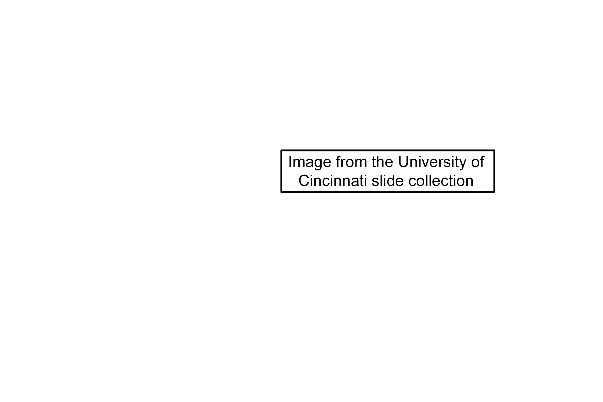 Image credit > <p>This image was taken of slide in the University of Cincinnati collection.</p>