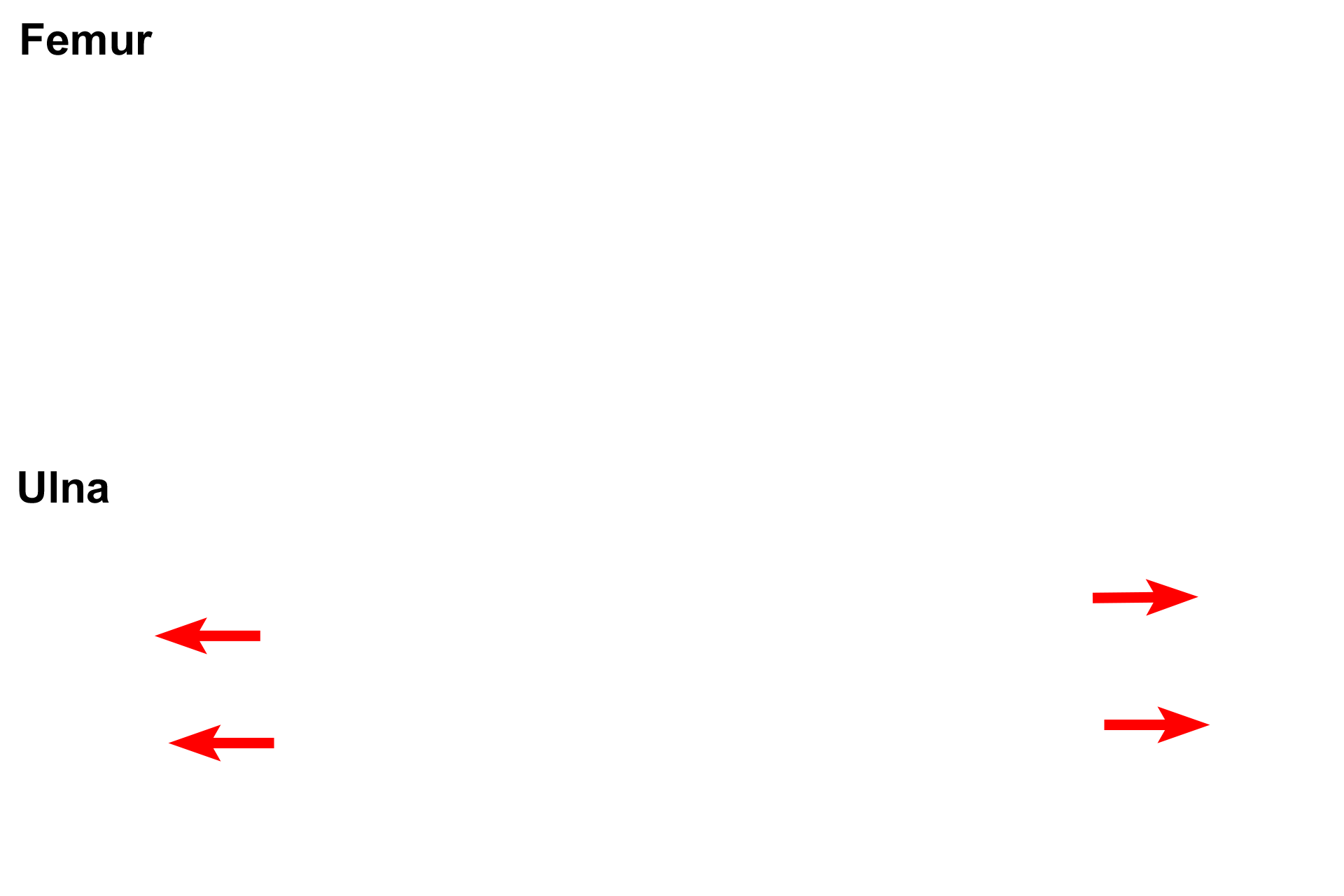 Epiphyseal lines > <p>Growth of bone in length ceases when the epiphyseal plate stops functioning and is replaced by bone (epiphyseal plate closure), leaving an epiphyseal line in its place.</p>