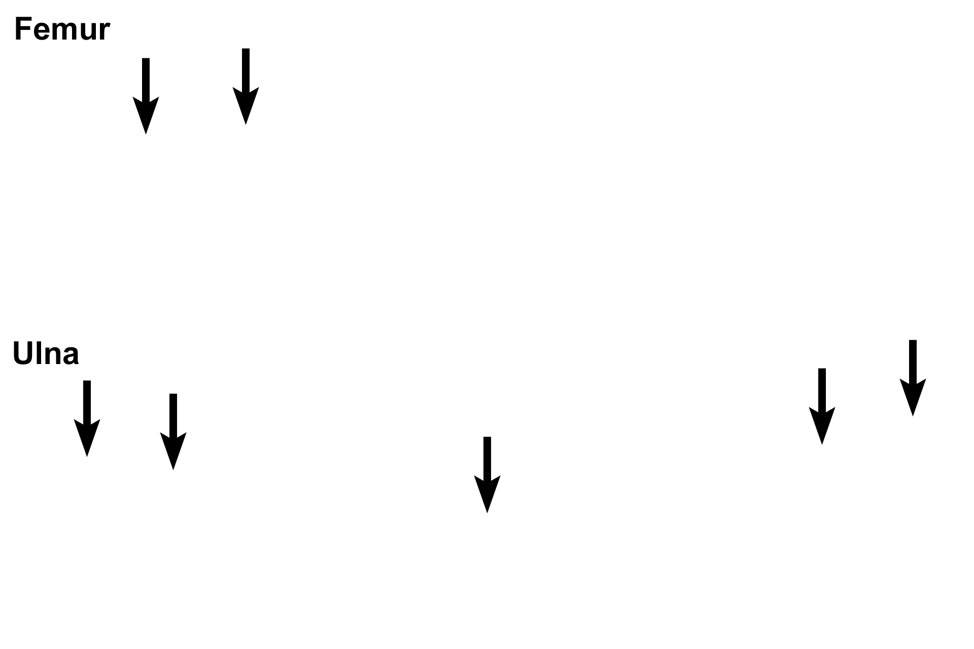 Endosteum > <p>The endosteum consists of a single layer of cells that line all interior bony surfaces except lacunae and canaliculi. The endosteum, like the periosteum, was not preserved in this preparation. </p>