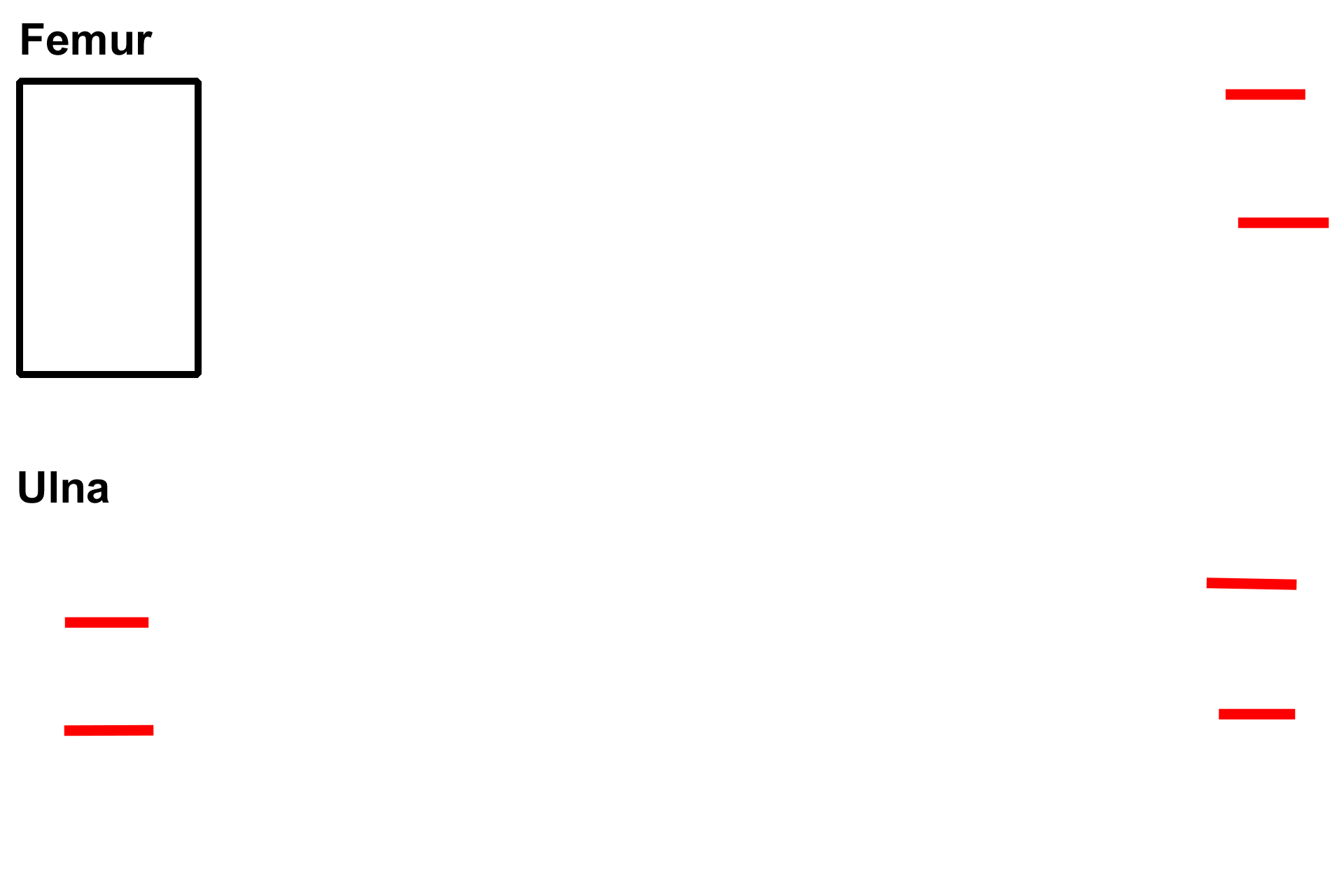 Epiphysis > <p>The epiphyses (singular epiphysis) are expanded regions at each end of a long bone. Epiphyses provide sites for muscle attachment and articulation with other bones.</p>