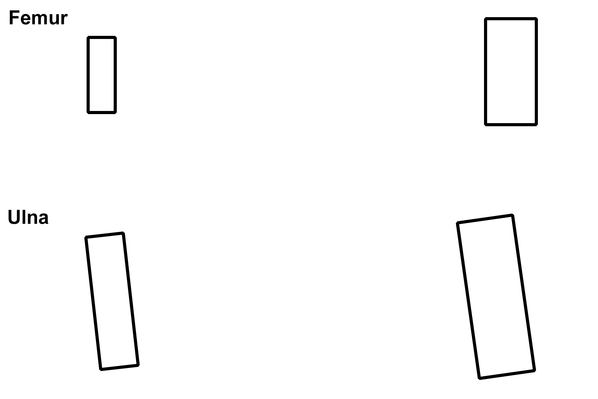 Metaphysis > <p>The metaphysis is a wedge-shaped region between the epiphysis and the diaphysis. </p>