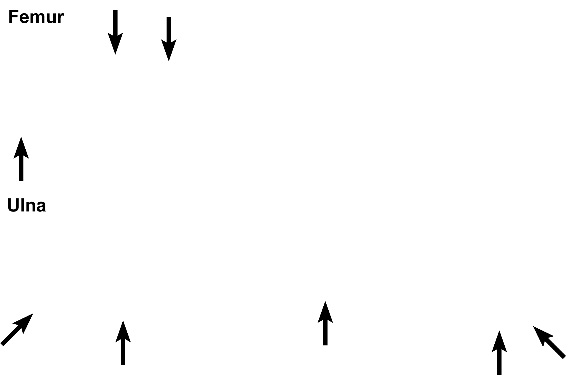 Compact bone > <p>Compact (cortical) bone covers all exterior surfaces of bones and forms the majority of the thick wall of the diaphysis in long bones. Compact bone appears solid to the naked eye.</p>