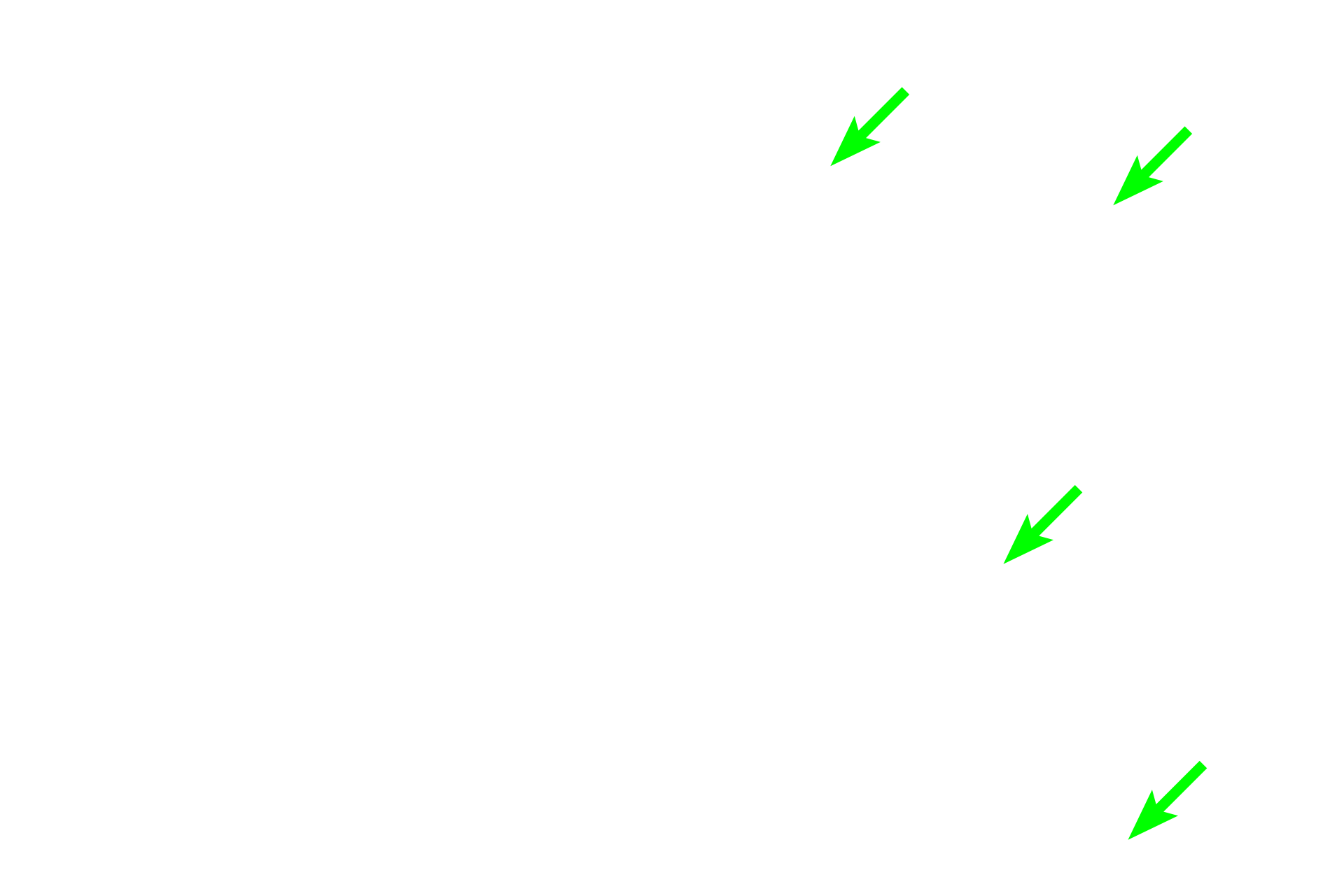 Red bone marrow > <p>Red marrow fills the spaces between spicules of spongy bone in the epiphyses of adults and is also present in the marrow cavity of younger individuals, as shown here. Red marrow consists of myeloid, (hemopoietic) tissue that produces red and white blood cells.</p>