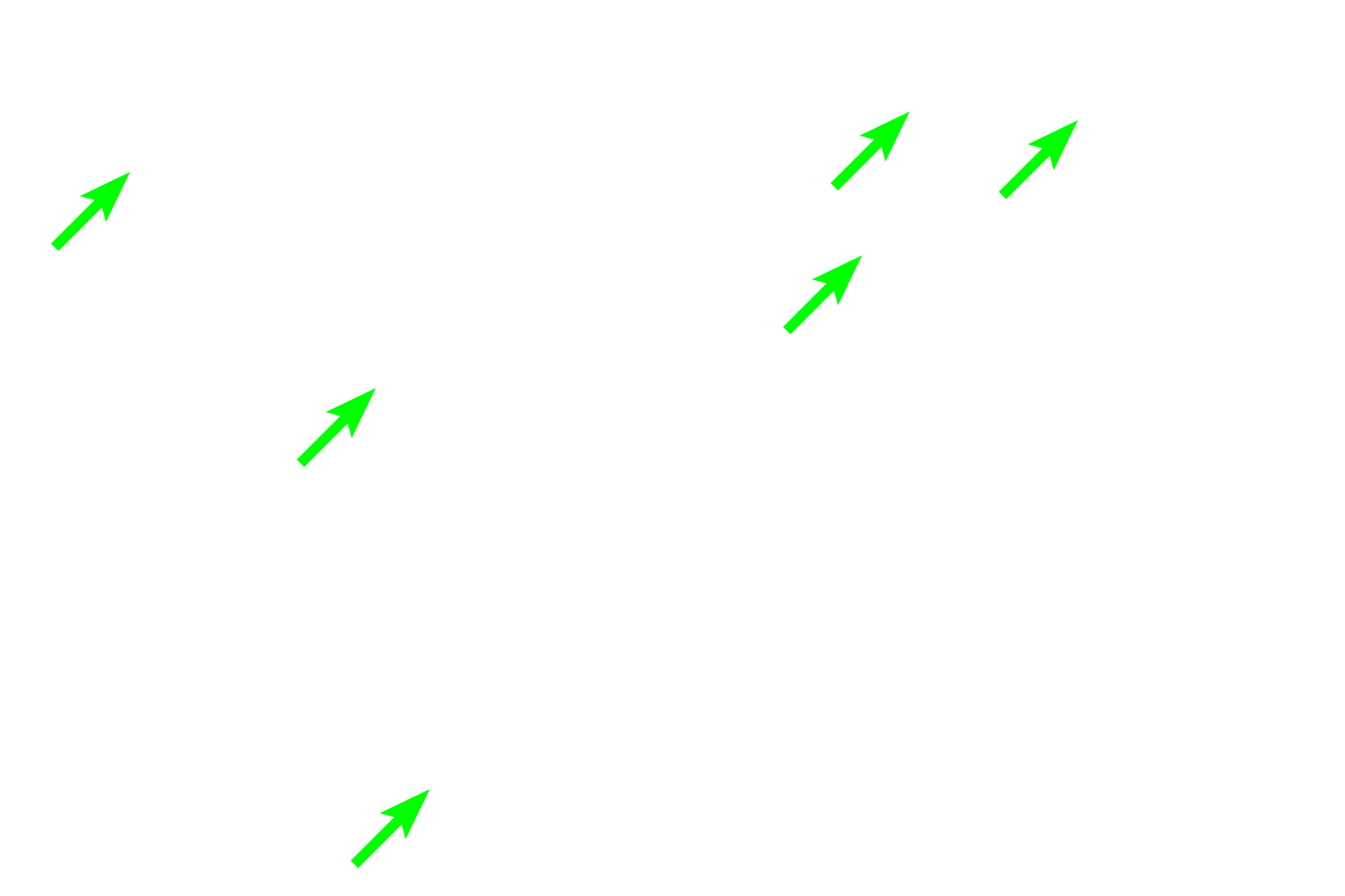 Spongy bone <p>Grossly, the bone tissue has two different appearances: compact and spongy. Compact (cortical) bone appears as a solid mass to the naked eye. This bone comprises the shafts of long bones and forms a peripheral layer over all bones, except in regions of articular cartilages. Spongy (cancellous) bone is found in the interior and resembles a sponge to the naked eye. It consists of a network of bony spicules or trabeculae, enclosing small marrow spaces. Spongy bone is present in the epiphyses and lining the interior of the diaphysis. 1x, 10x </p>