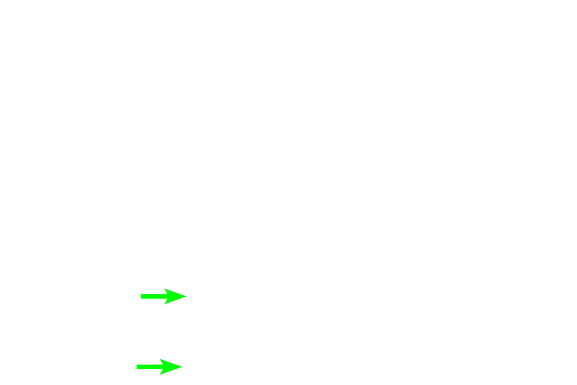 Yellow marrow > <p>Yellow marrow, composed of adipose tissue, replaces red marrow and fills the shafts of adult long bones. Marrow tissue was not preserved in the dried specimen. </p>
