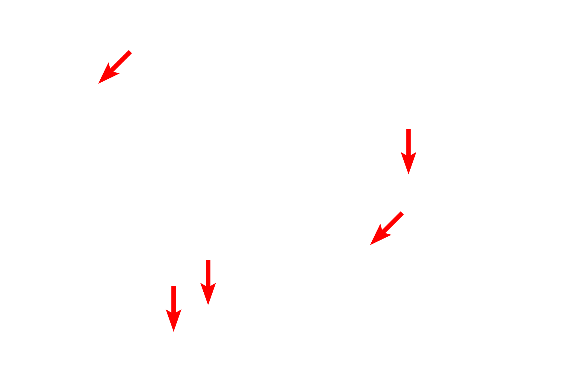 Volkmann's canals <p>This longitudinal view of compact, lamellar bone shows numerous, vertically-oriented Haversian canals and their interconnecting Volkmann’s canals. Because osteons are not perfectly straight, they pass in an out of the image plane. Ground bone, 200x</p>