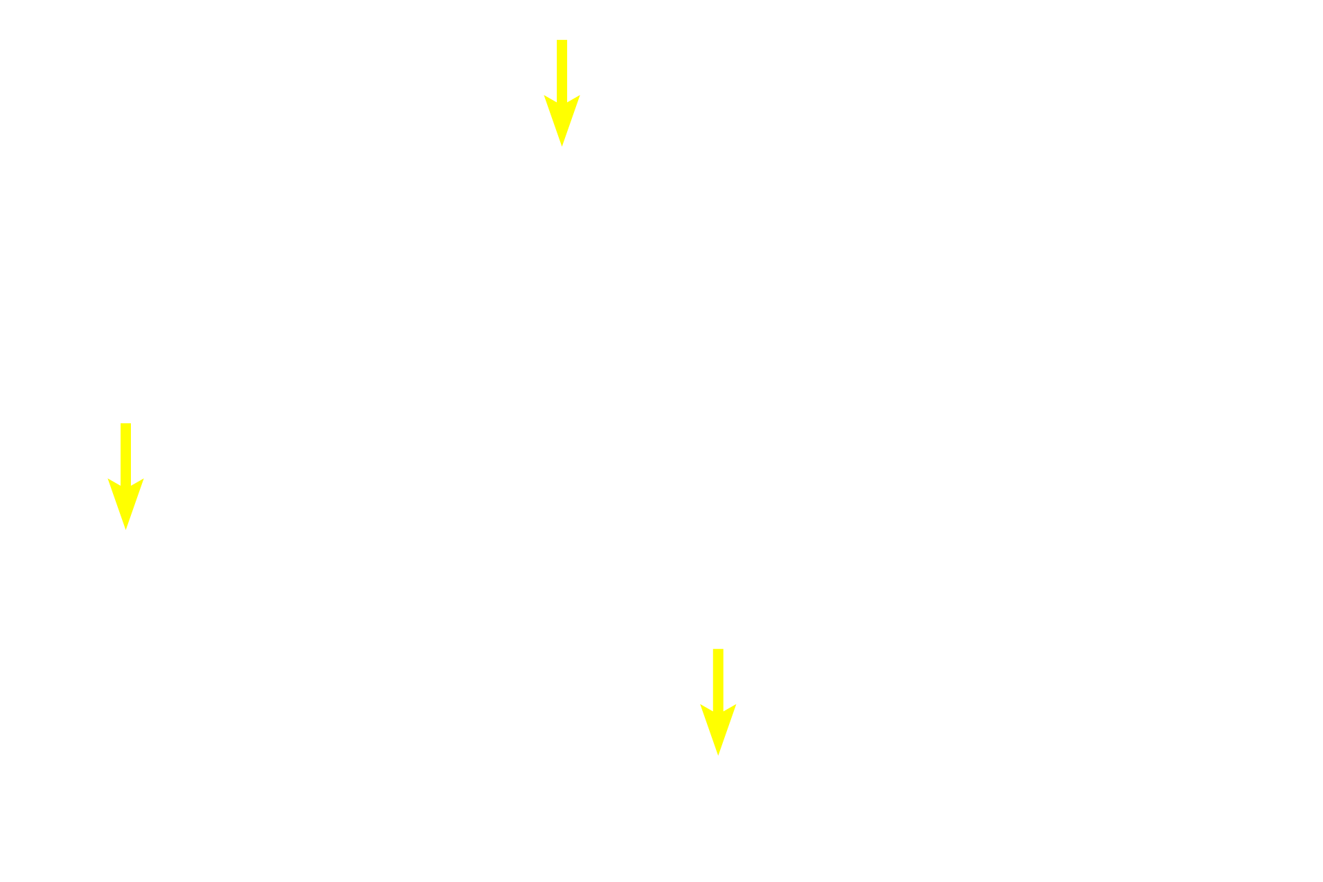 Blood vessels <p>Lamellar (mature) bone is organized in lamellae with orderly arranged, flattened lacunae between them. This organization gives lamellar bone more strength. In the bone shown here, the lamellae are arranged as cylindrical structures called Haversian systems or osteons with a central Haversian canal. This canal is lined by an endosteum and contains one or more blood vessels. On the surface of bones, these lamellae are arranged as flattened plates.</p>