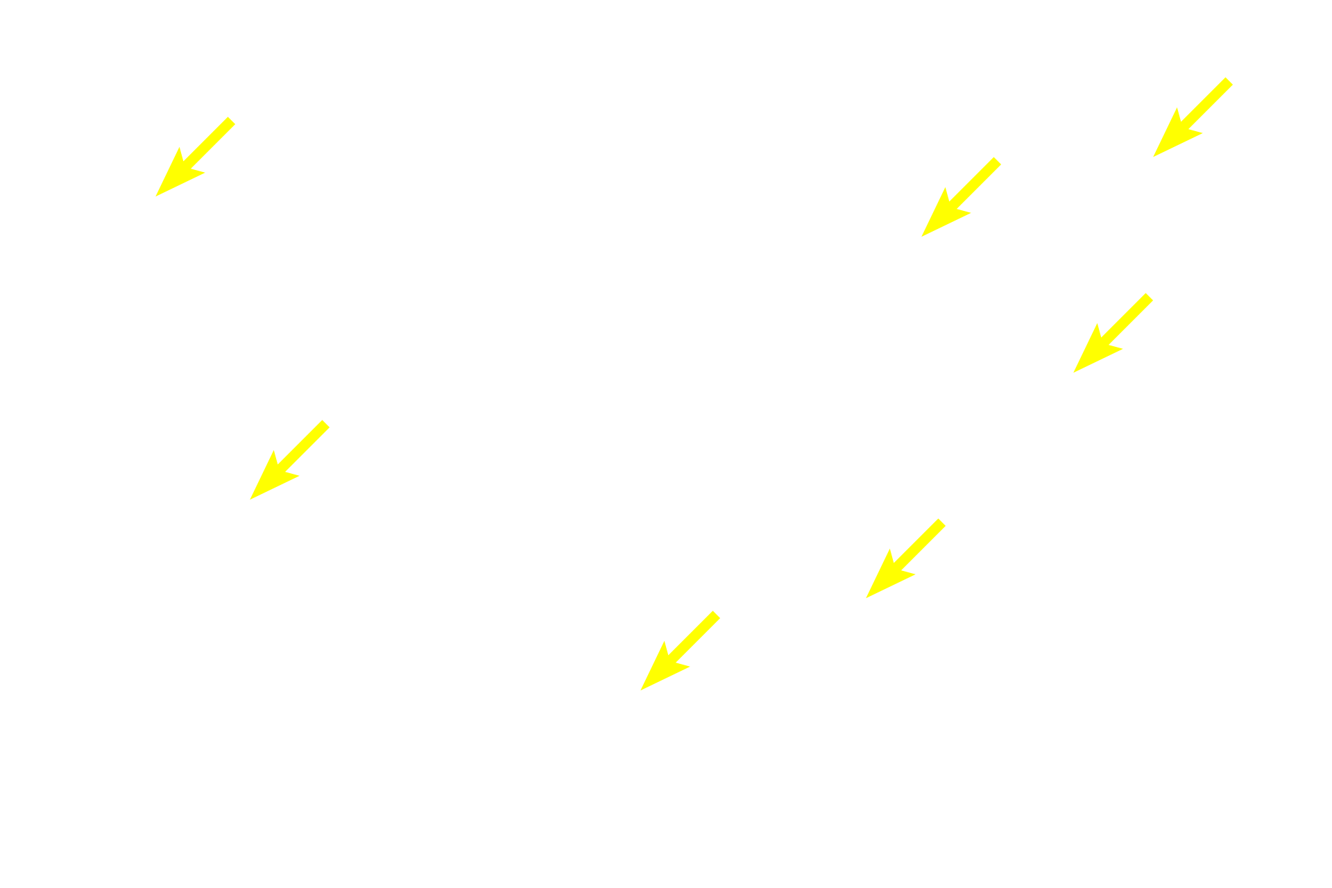 Osteocytes <p>This tissue is composed of both woven and lamellar bone. During both intramembranous and endochondral ossification, the first bone formed is woven bone which is gradually remodeled into lamellar bone. As a result, some areas will be composed of both woven and lamellar bone, as shown here. Similar event occur during adult remodeling and repair following a fracture. 600x</p>