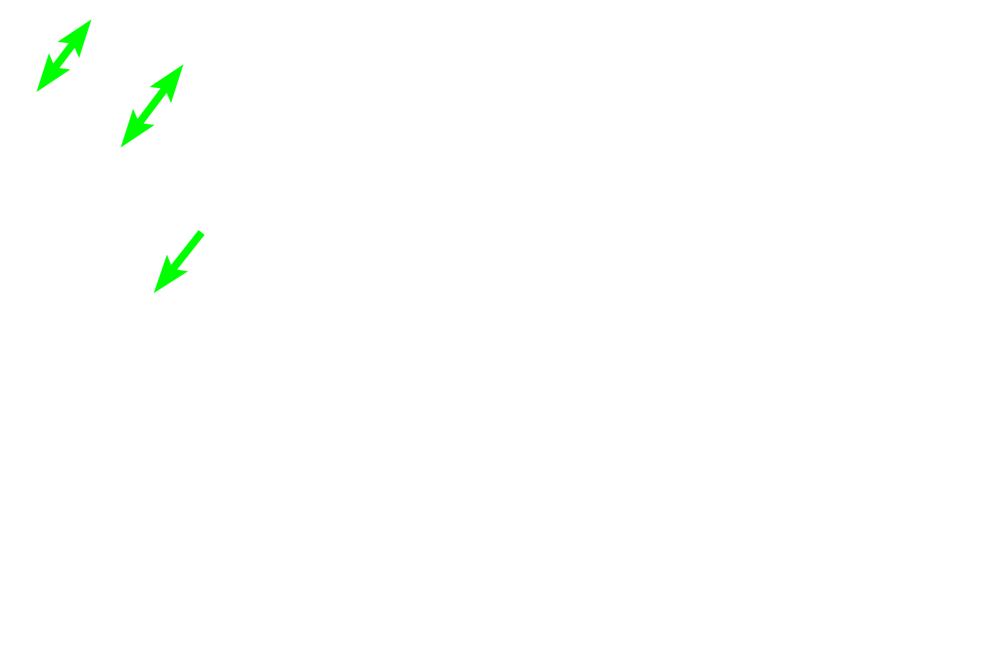 Spongy bone > <p>Spongy bone, also called cancellous or trabecular bone, forms a honeycombed structure composed of interconnected, microscopic bony spicules. The spaces between the spicules is filled with red marrow. Spongy bone fills the epiphysis and is also present in the marrow cavity.</p>