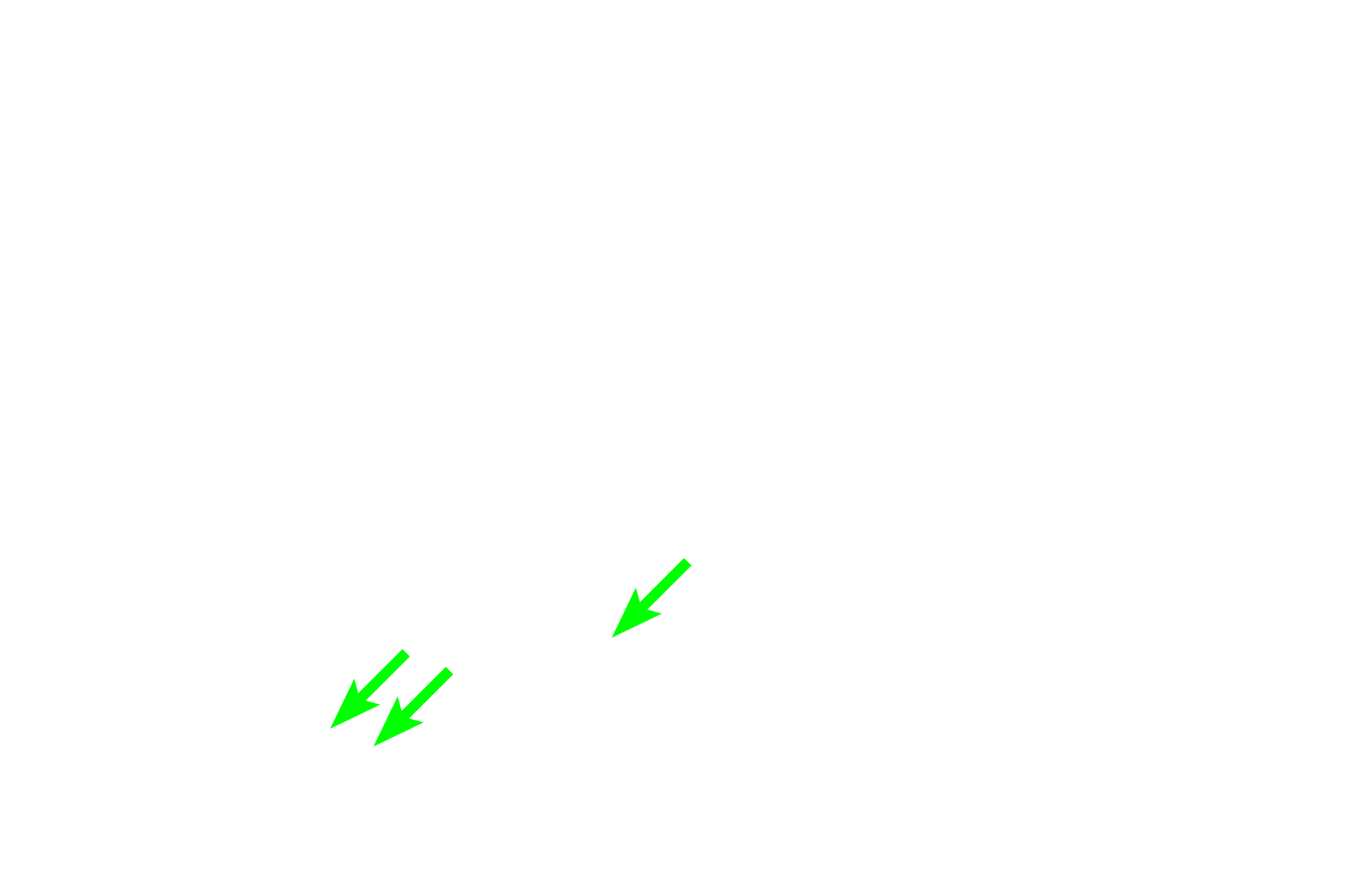 - Osteoid (organic matrix) > <p>Formation of the extracellular matrix of bone begins with deposition of the organic portion, osteoid, by osteoblasts. Osteoid appears as a pale band on the bone surface immediately beneath the active osteoblasts and consists mainly of type I collagen fibrils. Type I collagen fibrils comprise about 90% of the total protein of osteoid and thus the matrix is highly eosinophilic. In addition to collagen, osteoid also contains proteoglycan aggregates. Osteoid rapidly becomes mineralized with calcium phosphate (hydroxyapatite). </p>