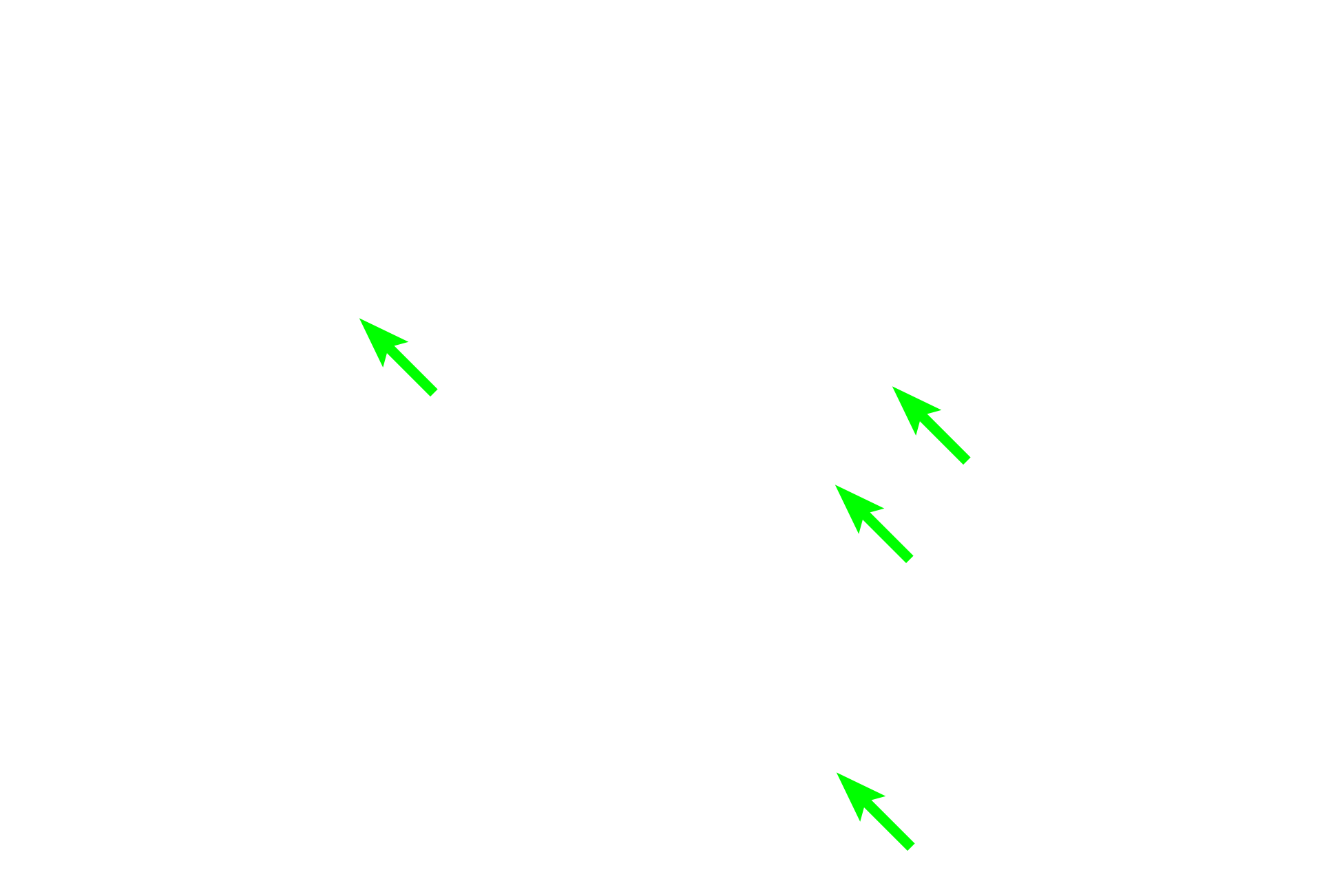- Blood vessels <p>The spicule is surrounded by red bone marrow which produces all the circulating blood cells. Numerous blood vessels (sinusoids) in the bone marrow serve to transport newly formed blood cells into the general circulation. </p>