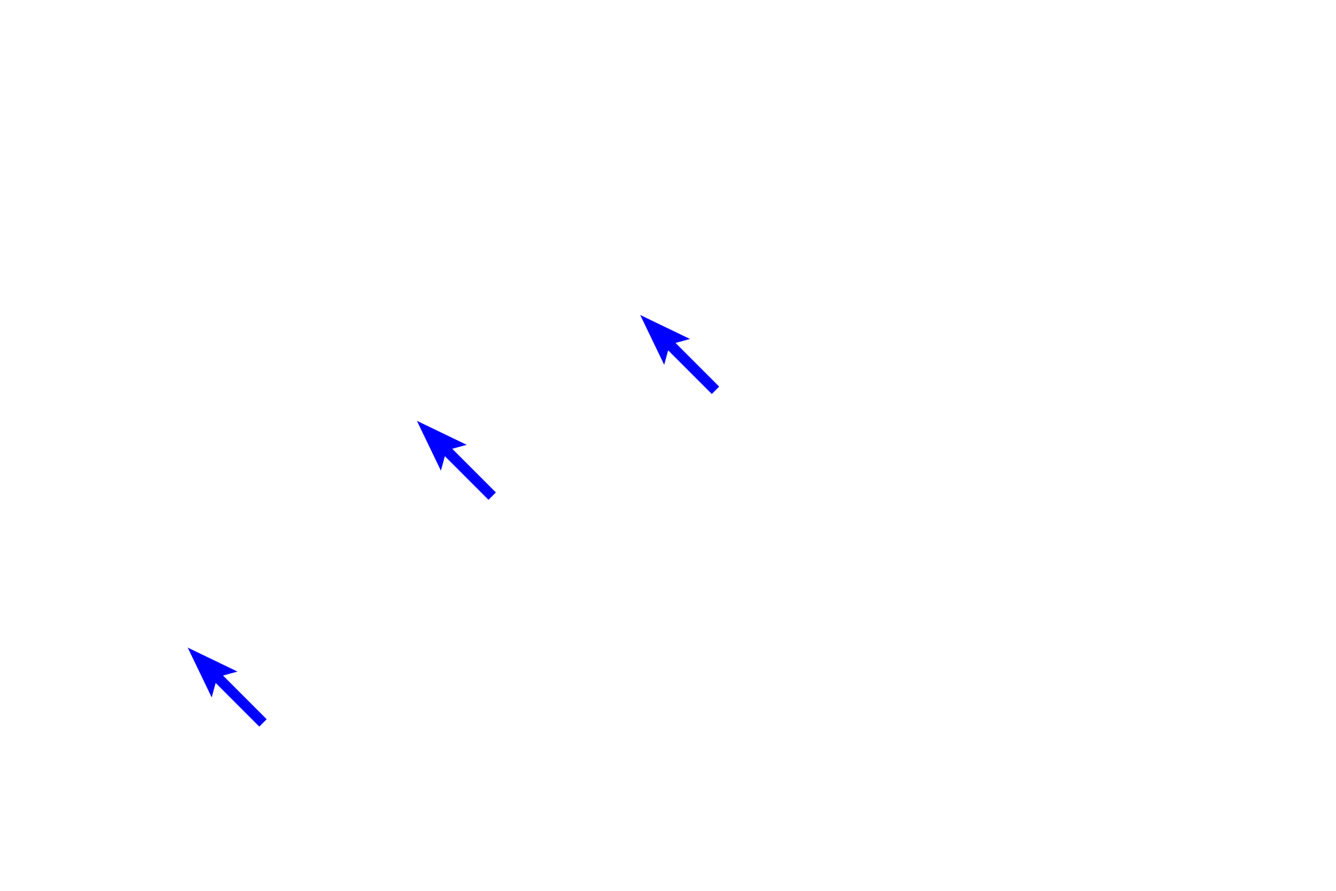 Osteocytes <p>Bone cells function to produce bone (osteoblasts), maintain bone (osteocytes) and degrade bone (osteoclasts). Each of these cells types is visible in this image of a developing bone spicule. 400x</p>