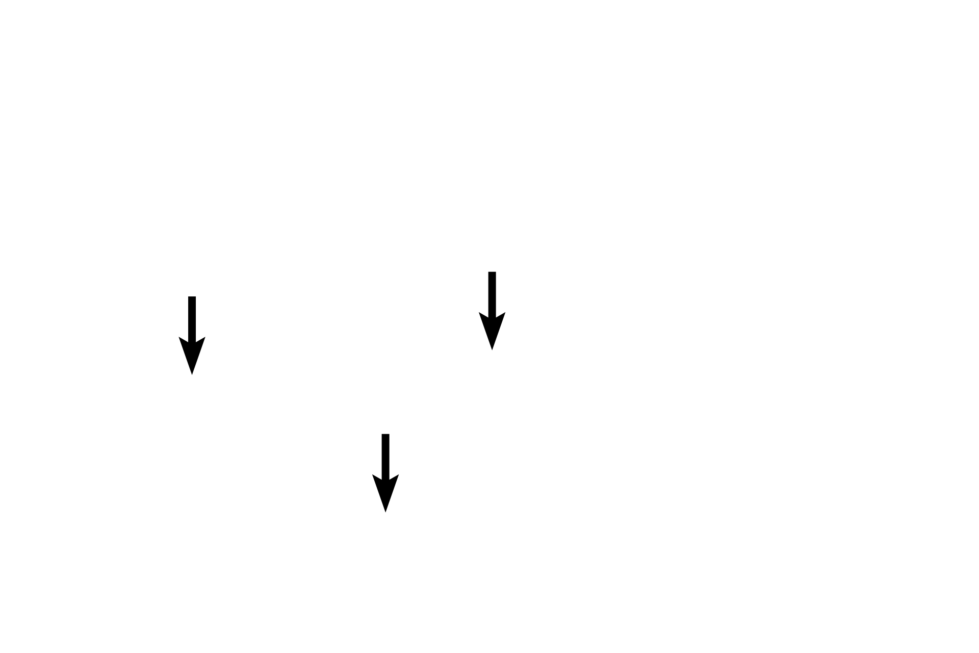 Osteocytes in lacunae <p>This spicule of bone is being resorbed by multiple osteoclasts, large, motile cells with multiple nuclei. Throughout life, bone is resorbed and deposited to both renew and repair the matrix and to respond to mechanical stresses. Resorption results in the formation of depressions in the bone called Howship’s lacunae. Osteoclasts belong to the monocyte lineage and are not related to osteoblasts or osteocytes. Spongy woven bone, 600x</p>