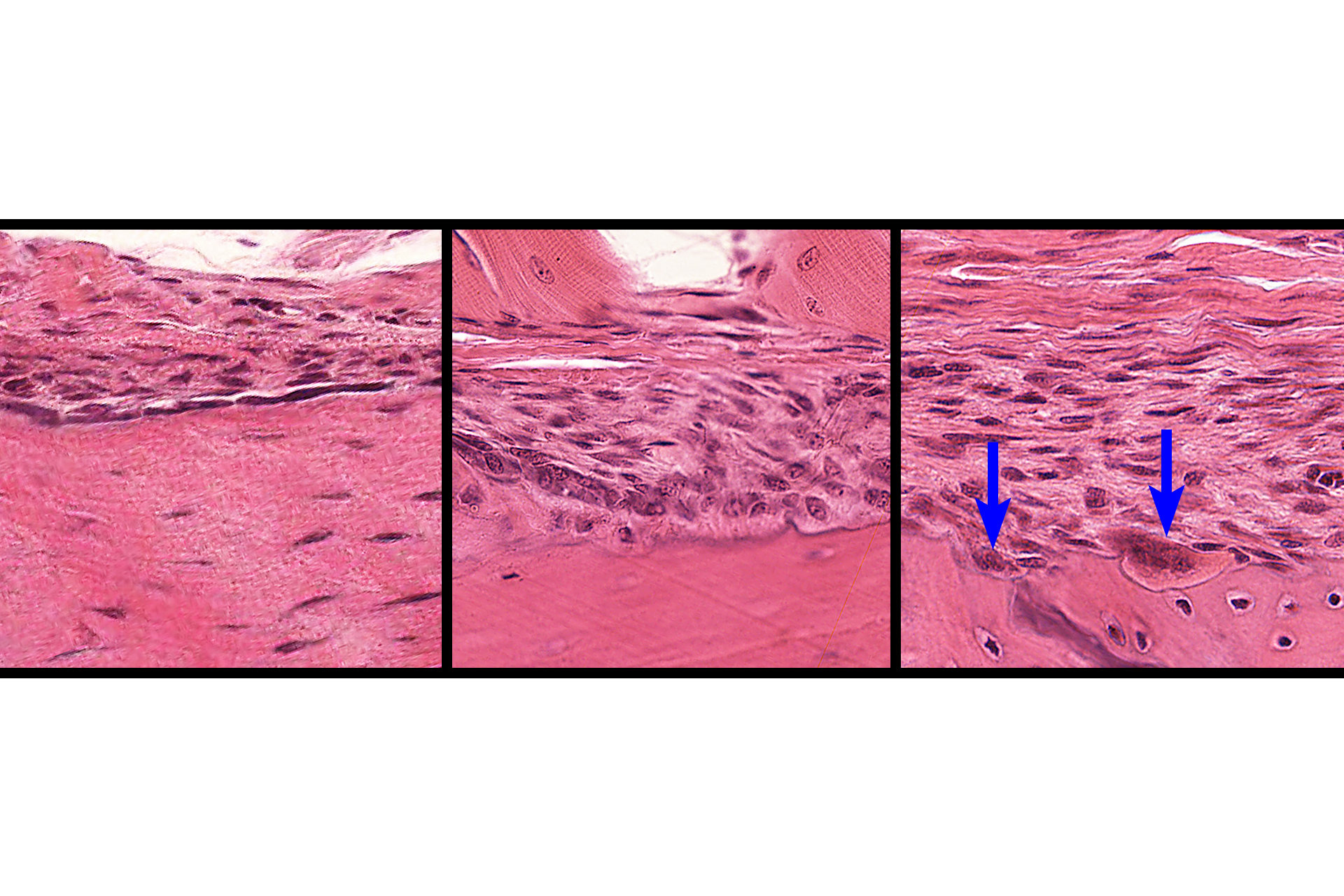 Cells of the endosteum and periosteum > <p>In non-active regions of both periosteum and endosteum, bone lining cells are most prevalent (left panel). These cells also include osteoprogenitor cells. In areas of active bone deposition (center panel), cuboidal osteoblasts are present; areas of bone resorption (right panel) are marked by the presence of osteoclasts (arrows). </p>