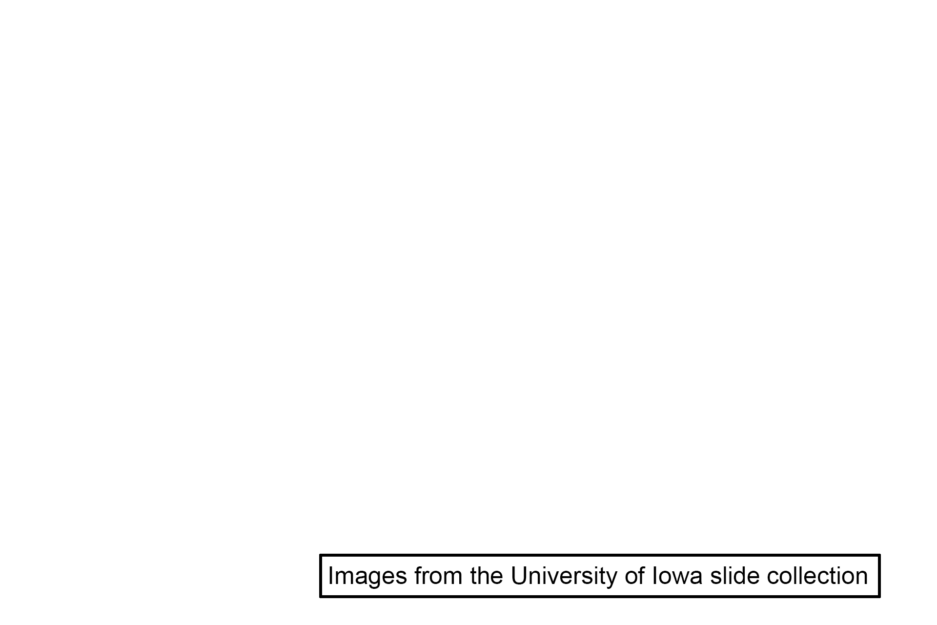 Image source > <p>Images taken of a slide in the University of Iowa slide collection.</p>