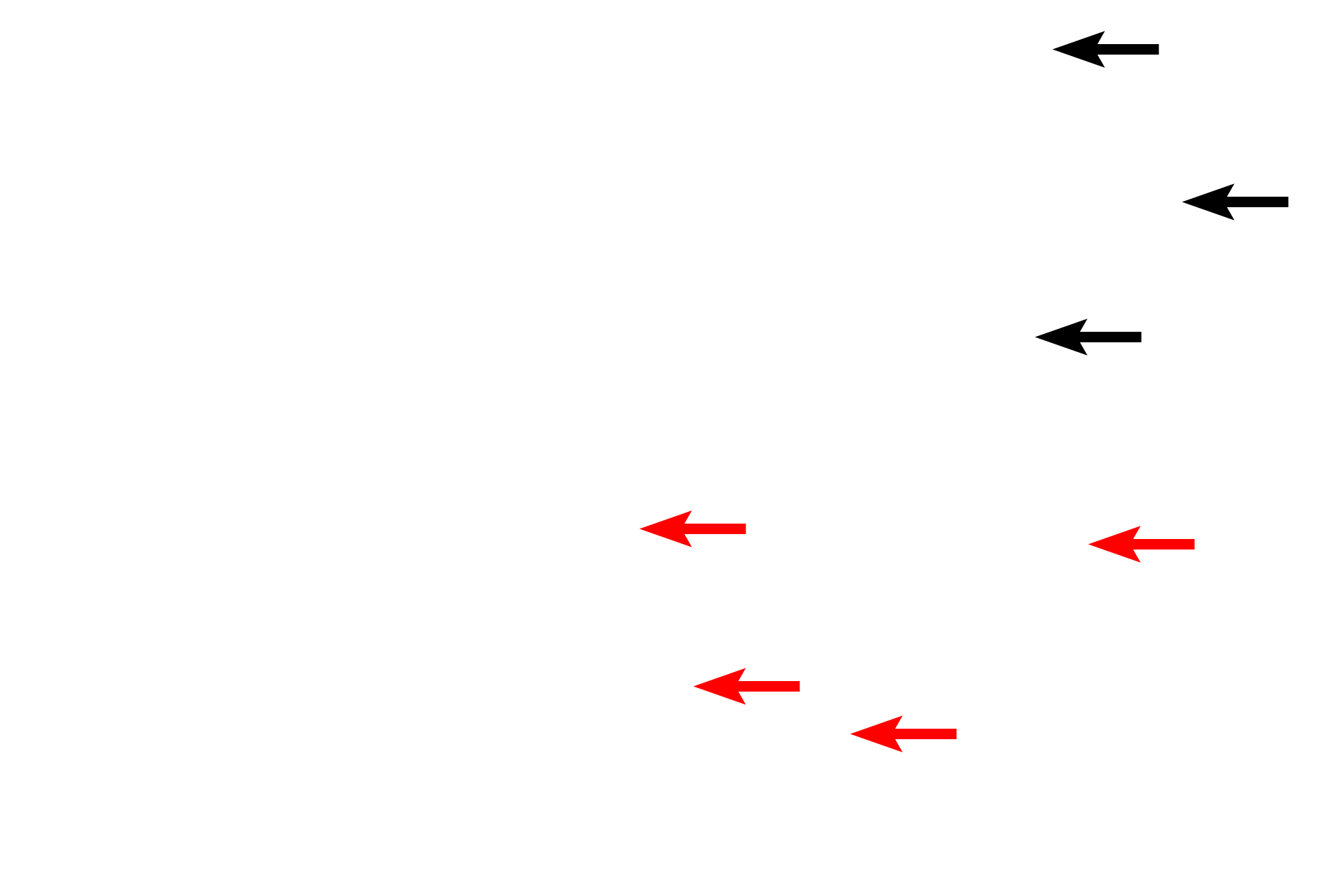 Haverian canals > <p>Haversian canals are centrally located in each osteon and possess a blood vessel needed for maintenance of the bone. Branches of these vessels travel in horizontally-oriented Volkmann’s canals. Both Haversian and Volkmann’s canals are lined by endosteum which is continuous with the endosteum of the marrow cavity. </p>