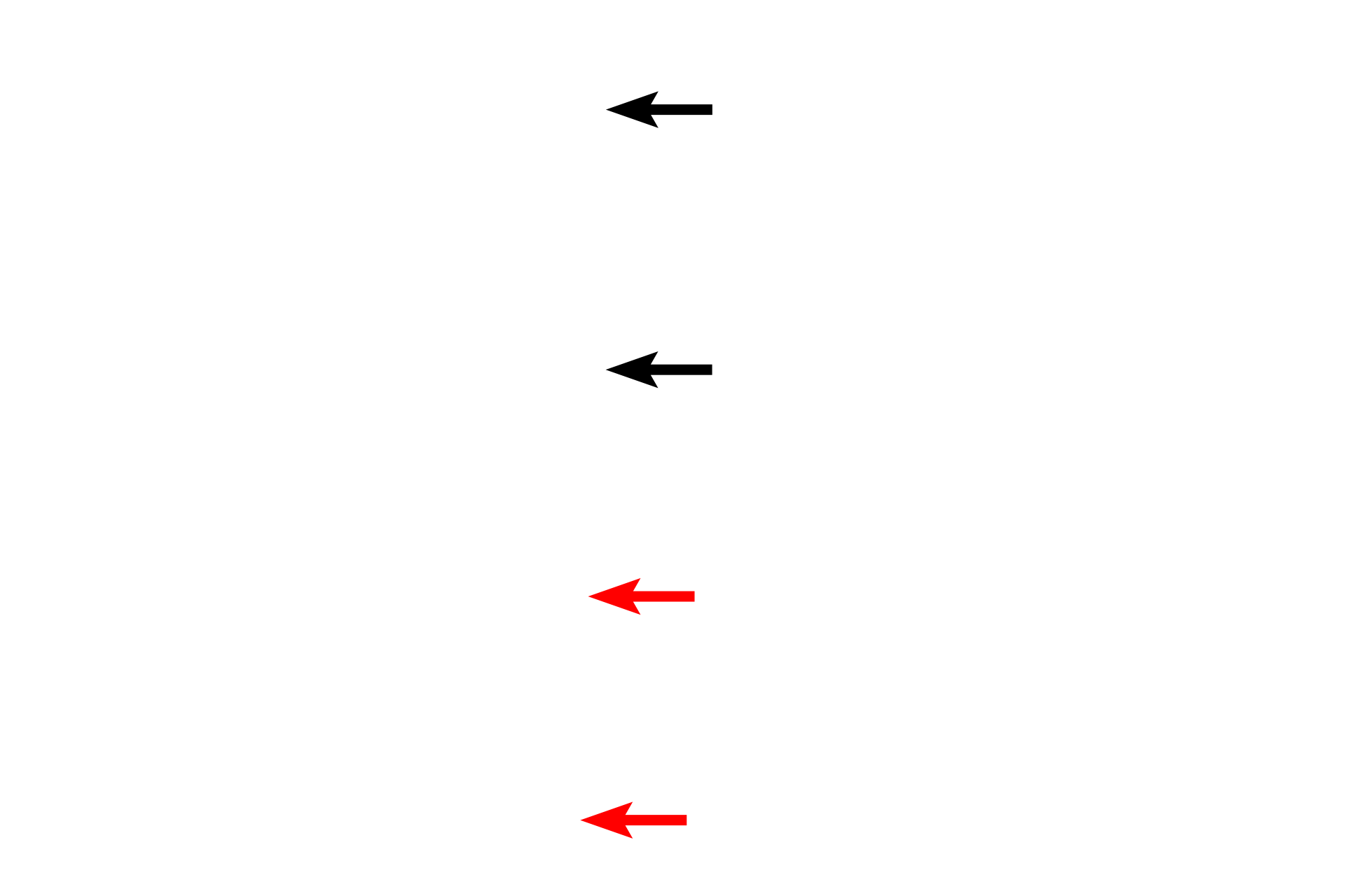 Circumferential lamellae > <p>Compact bone is also be deposited in layers on exterior and interior bony surfaces, forming circumferential lamellae. </p>