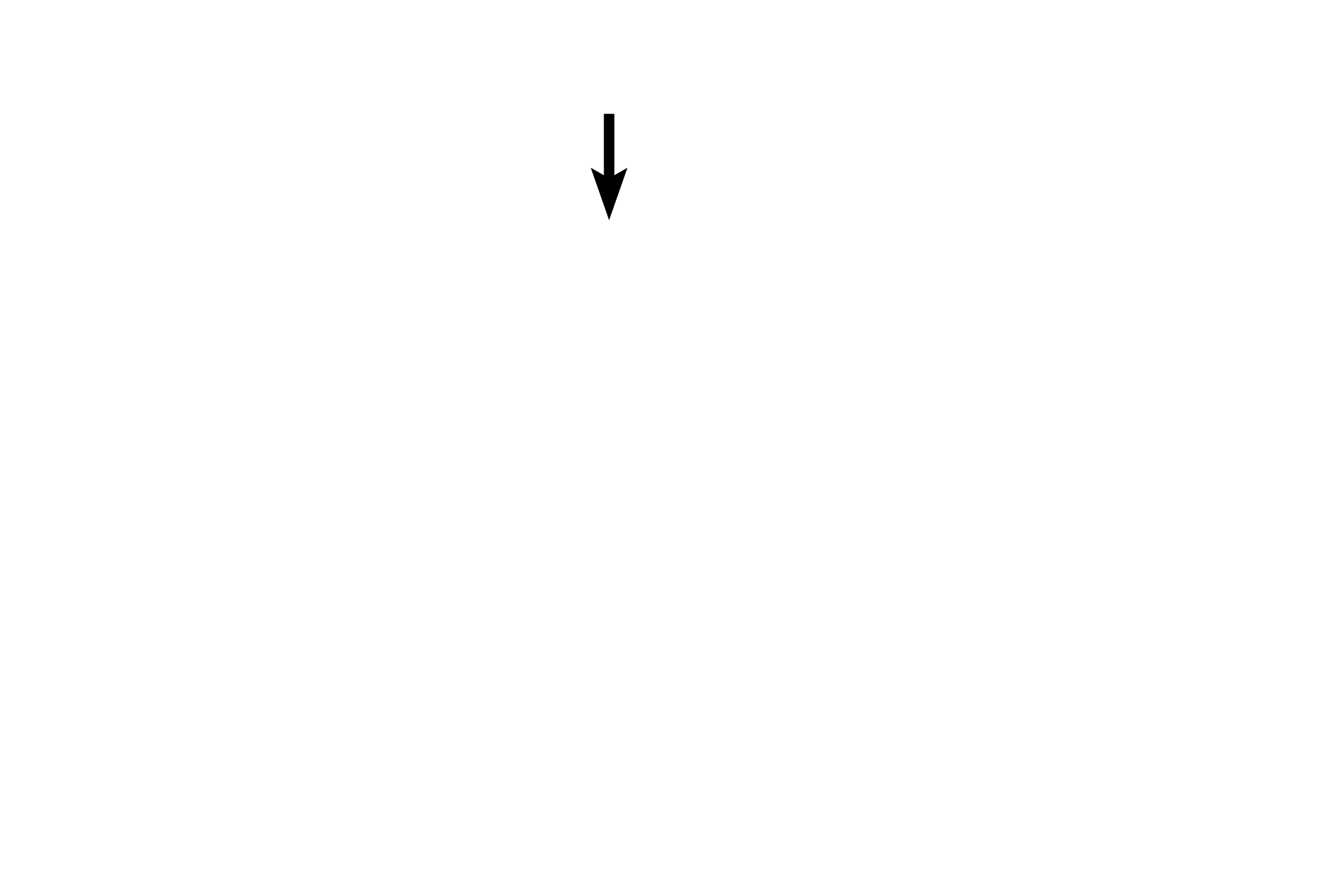 Nutrient vessel > <p>A nutrient vessel is visible entering from the marrow cavity. The space it occupies is lined by endosteum.</p>