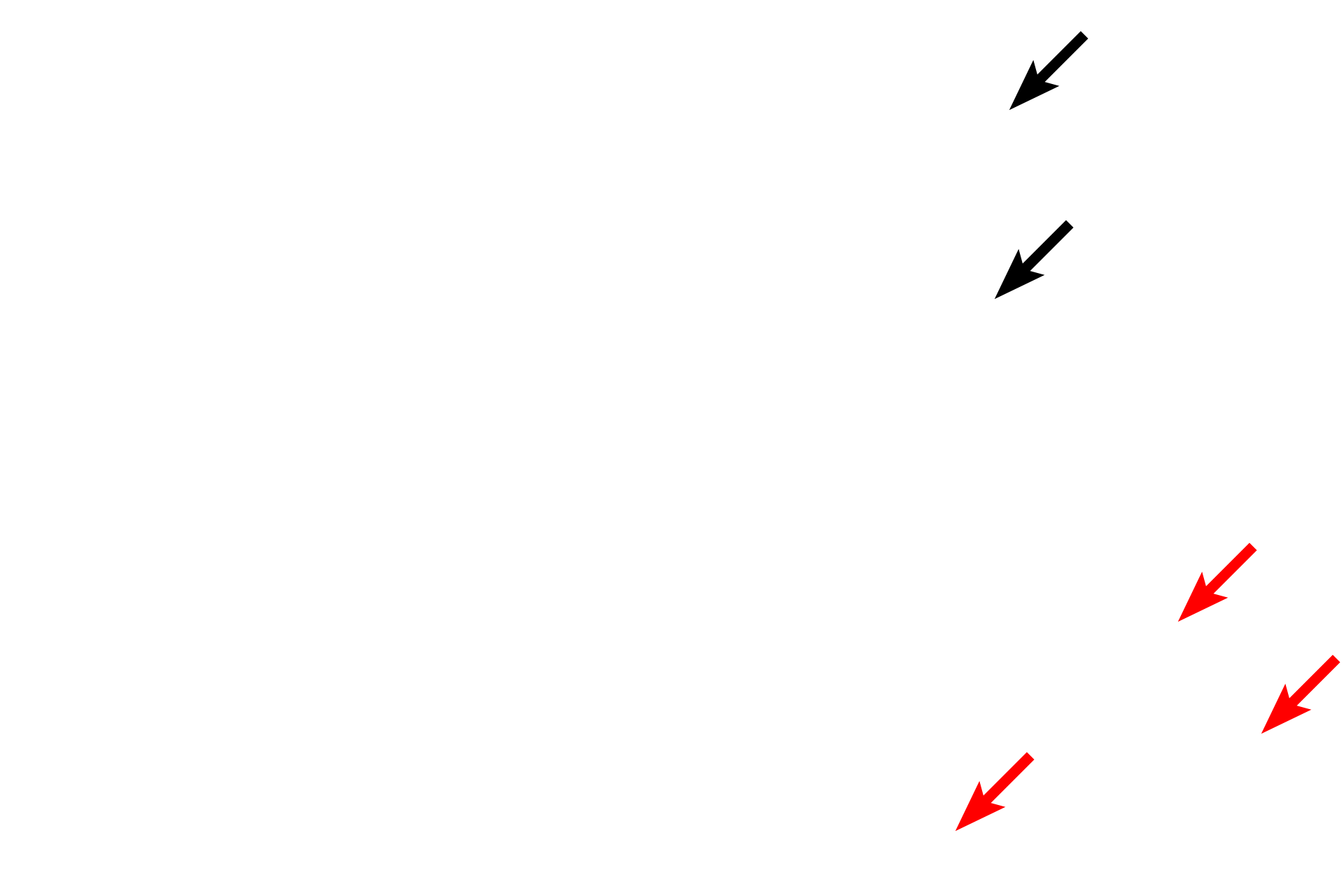 Volkmann's canals <p>Haversian canals are centrally located in each osteon and possess a blood vessel needed for maintenance of the bone. Branches of these vessels travel in horizontally-oriented Volkmann’s canals. Both Haversian and Volkmann’s canals are lined by endosteum which is continuous with the endosteum of the marrow cavity. </p>