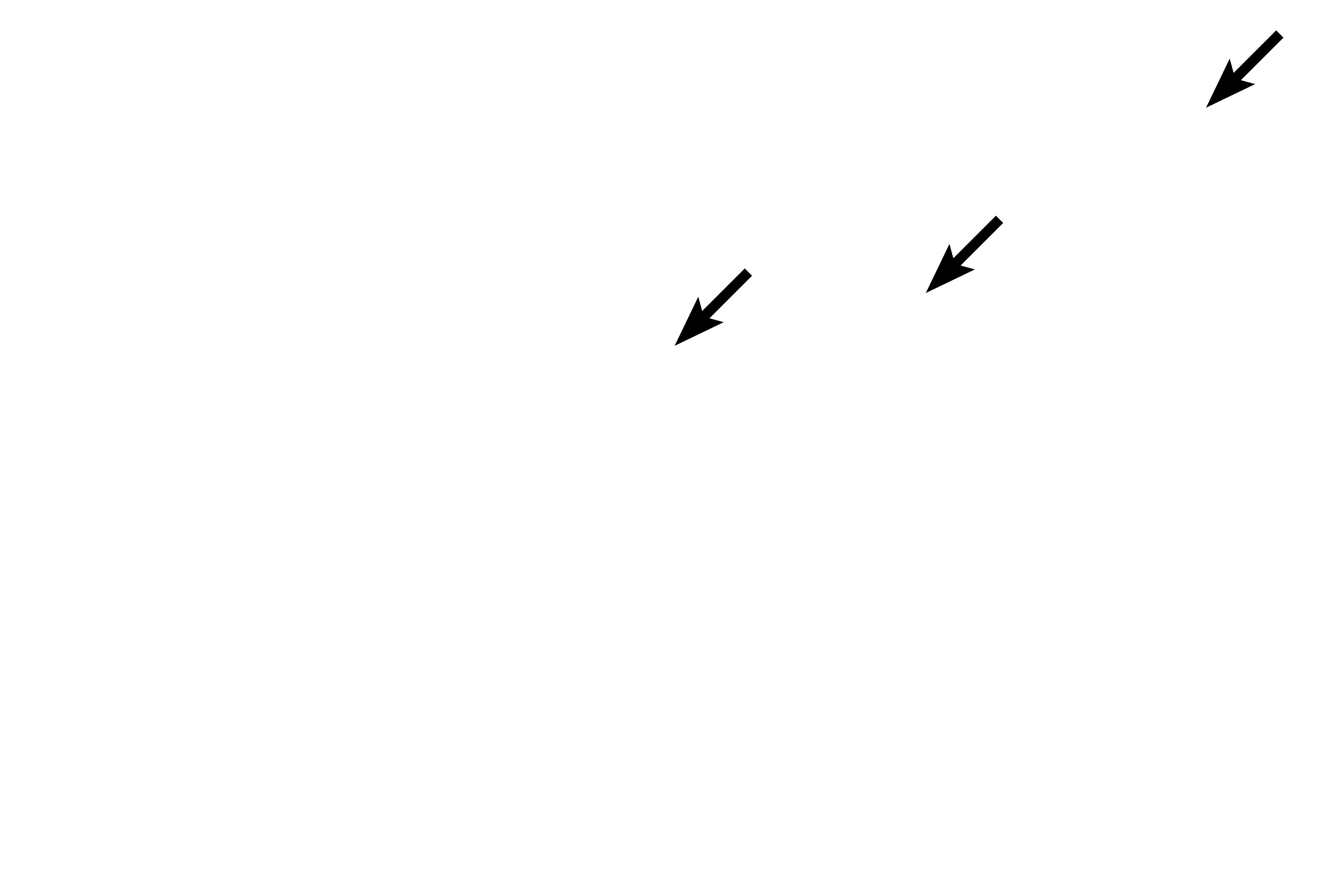 Endosteum > <p>Within compact bone, endosteum lines Haversian and Volkmann’s canals. It does not extend into lacunae or canaliculi.</p>