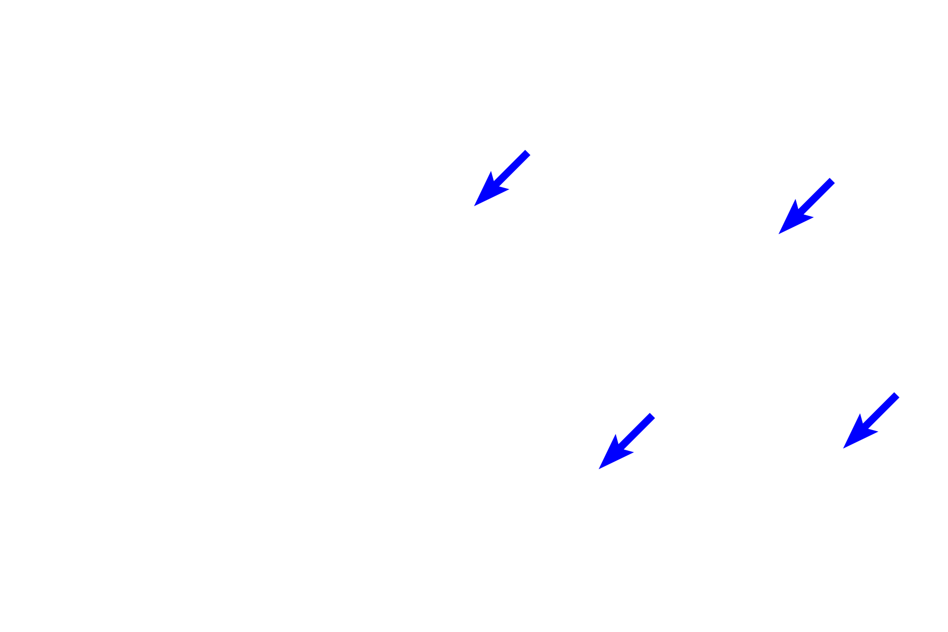 - Chondrocytes <p>The ends of long bones are covered by articular cartilage, formed of hyaline cartilage, providing a smooth, glassy surface that allows the ends of the bones to move easily on each other. This type of articulation is called a synovial joint. Articular cartilages, which are not covered by periosteum, are separated by a fluid-filled synovial space. A thin layer of compact bone lies beneath the cartilage. 10x, 800x </p>