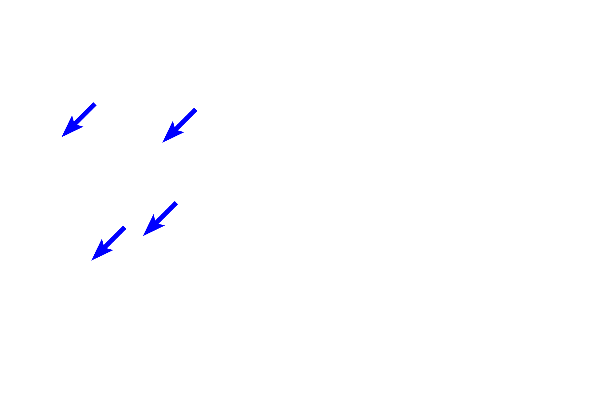 Spongy bone <p>The ends of long bones are covered by articular cartilage, formed of hyaline cartilage, providing a smooth, glassy surface that allows the ends of the bones to move easily on each other. This type of articulation is called a synovial joint. Articular cartilages, which are not covered by periosteum, are separated by a fluid-filled synovial space. A thin layer of compact bone lies beneath the cartilage. 10x, 800x </p>
