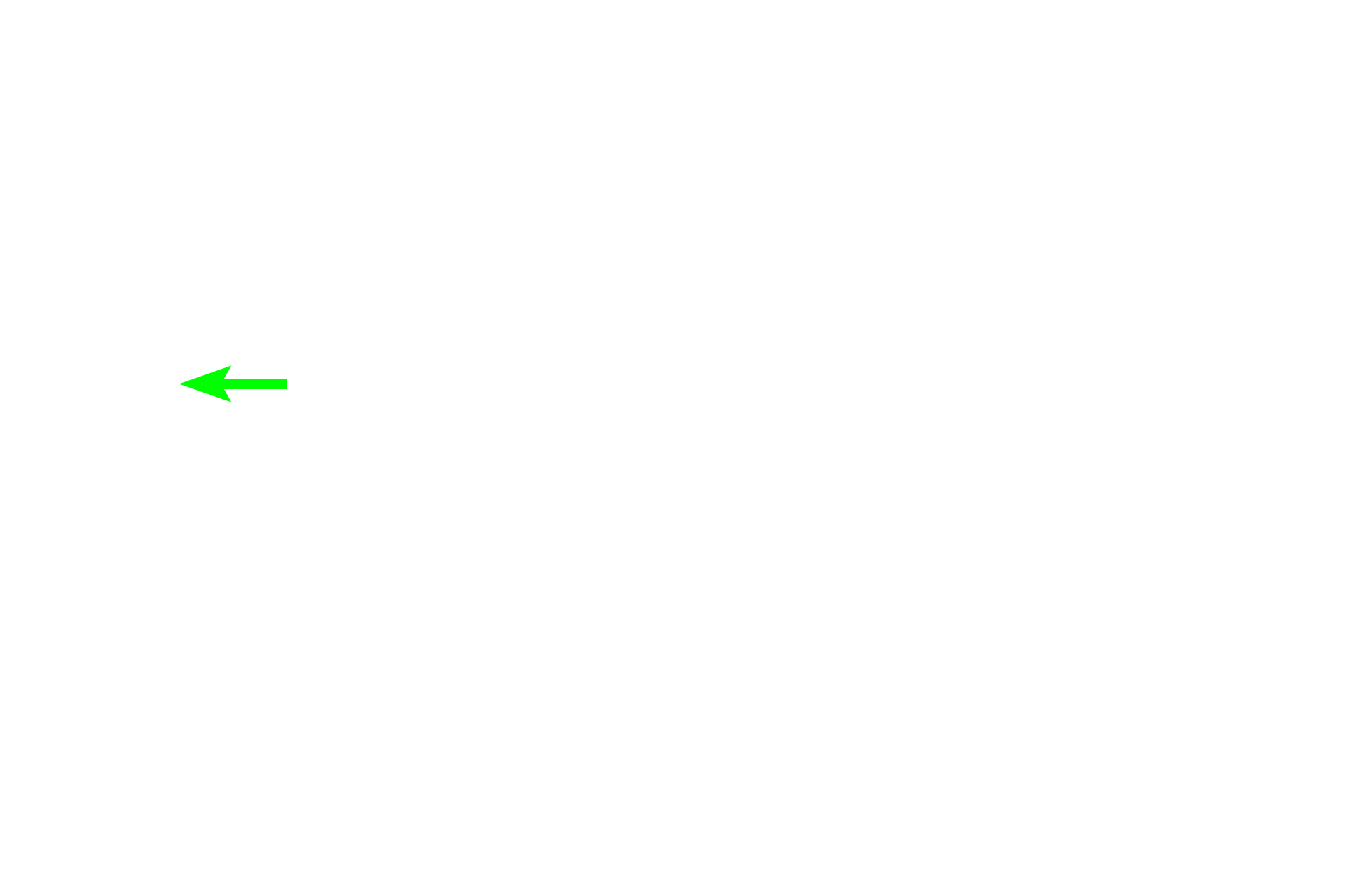 - Right <p>This image shows bone tissue at the inner surface along with its endosteal covering.</p>